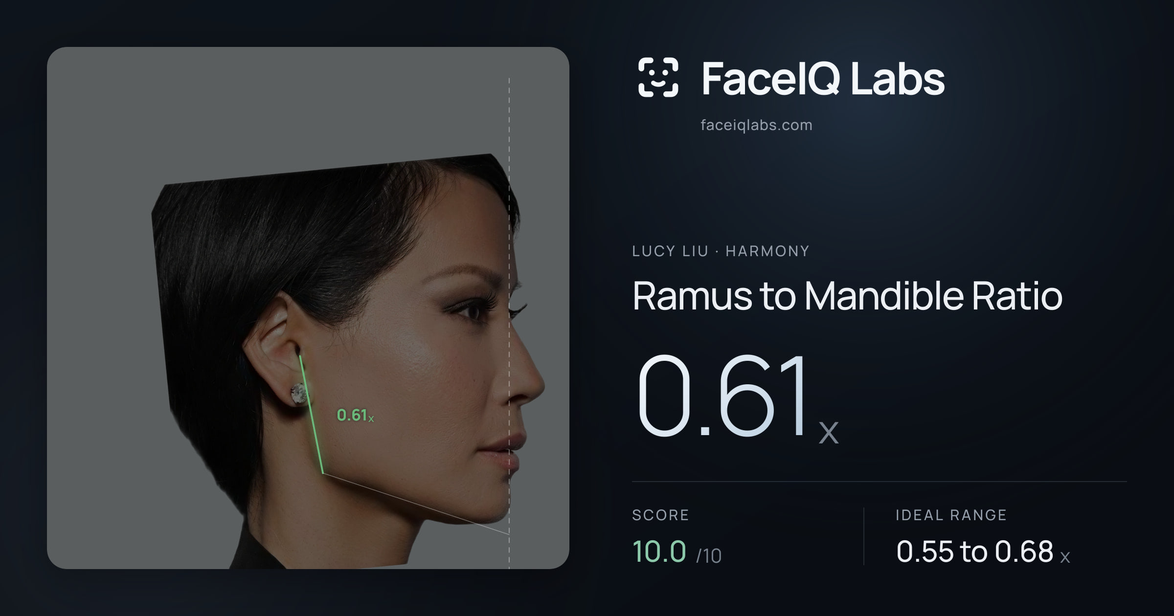 Lucy Liu Ramus to Mandible Ratio: 0.61x, drawn on the photo