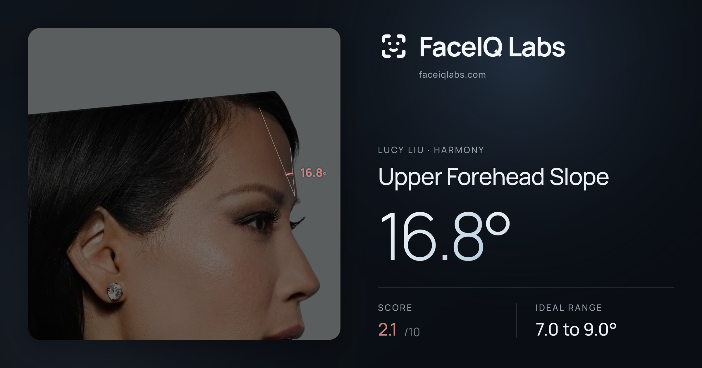 Lucy Liu Upper Forehead Slope: 16.8°, drawn on the photo