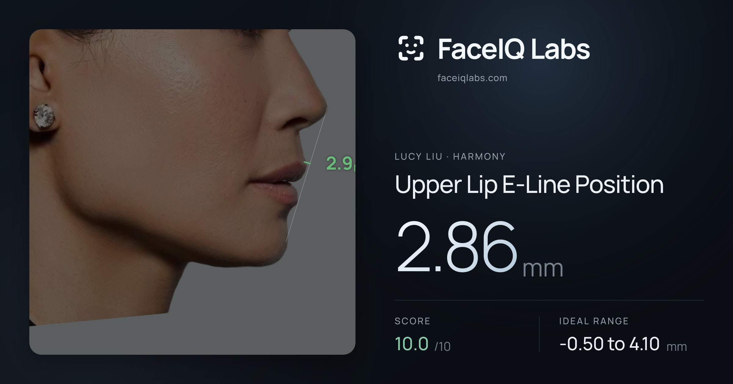 Lucy Liu Upper Lip E-Line Position: 2.86mm, drawn on the photo