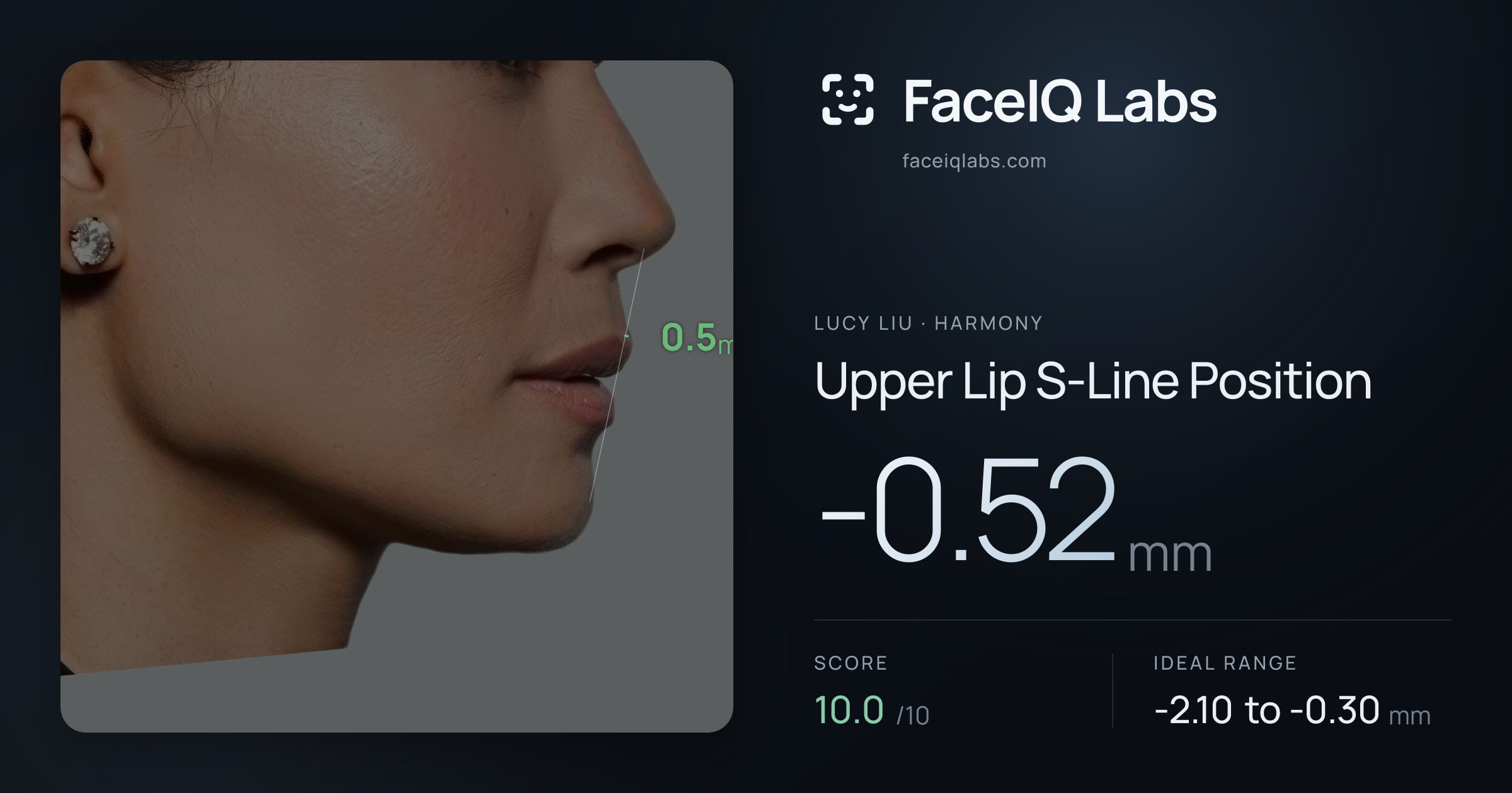 Lucy Liu Upper Lip S-Line Position: -0.52mm, drawn on the photo
