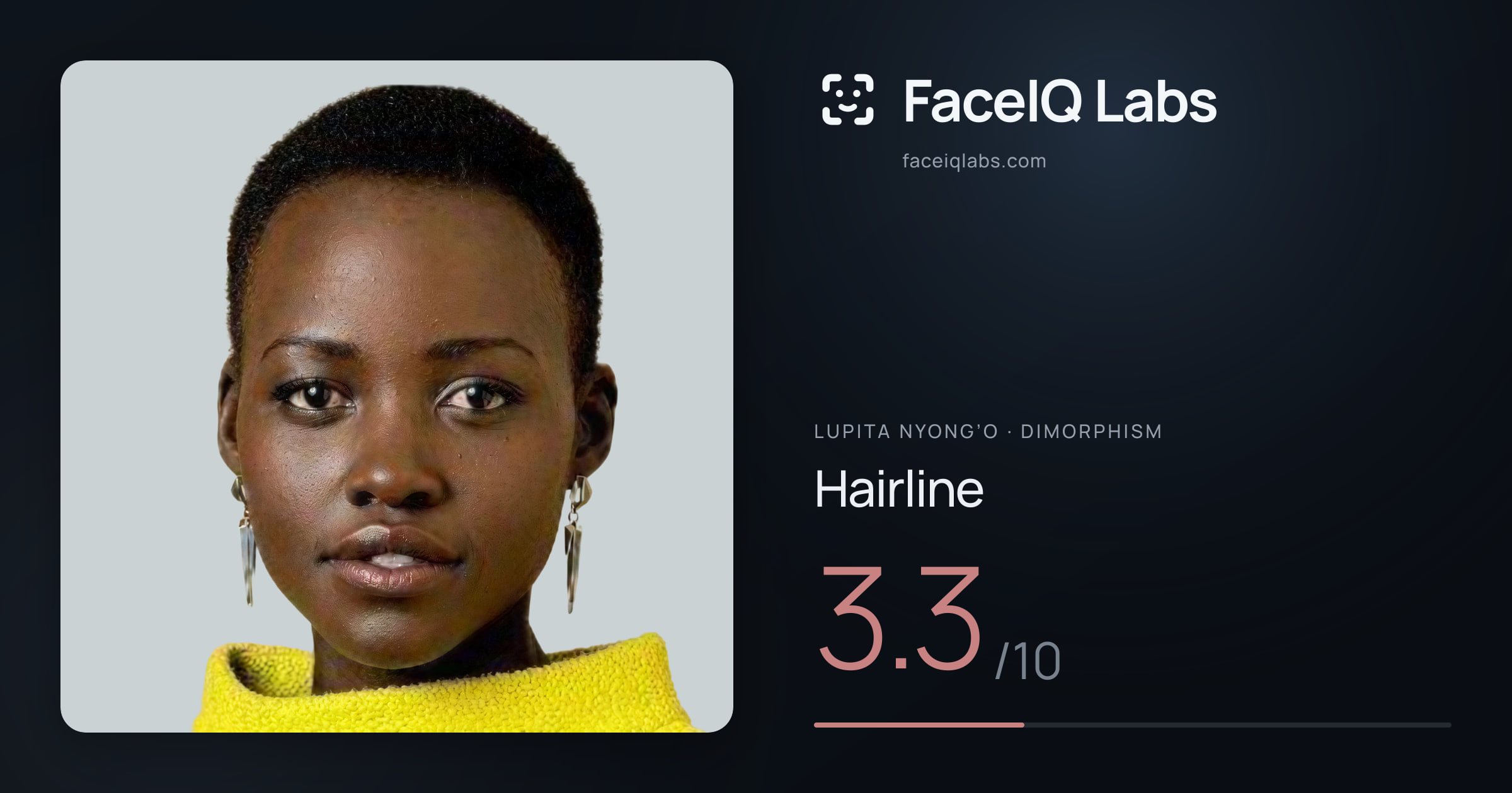 Lupita Nyong’o Hairline: 3.3/10, drawn on the photo