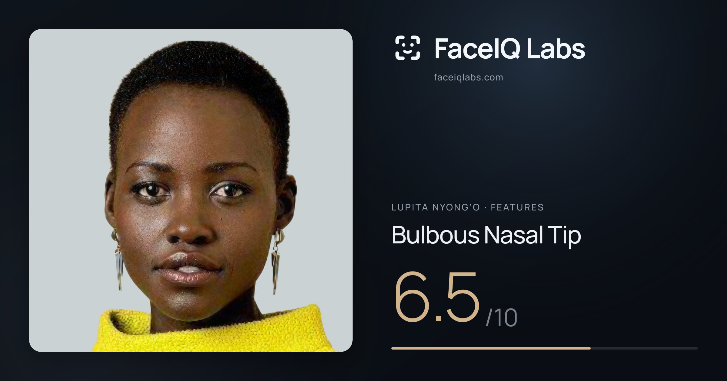Lupita Nyong’o Bulbous Nasal Tip: 6.5/10, drawn on the photo