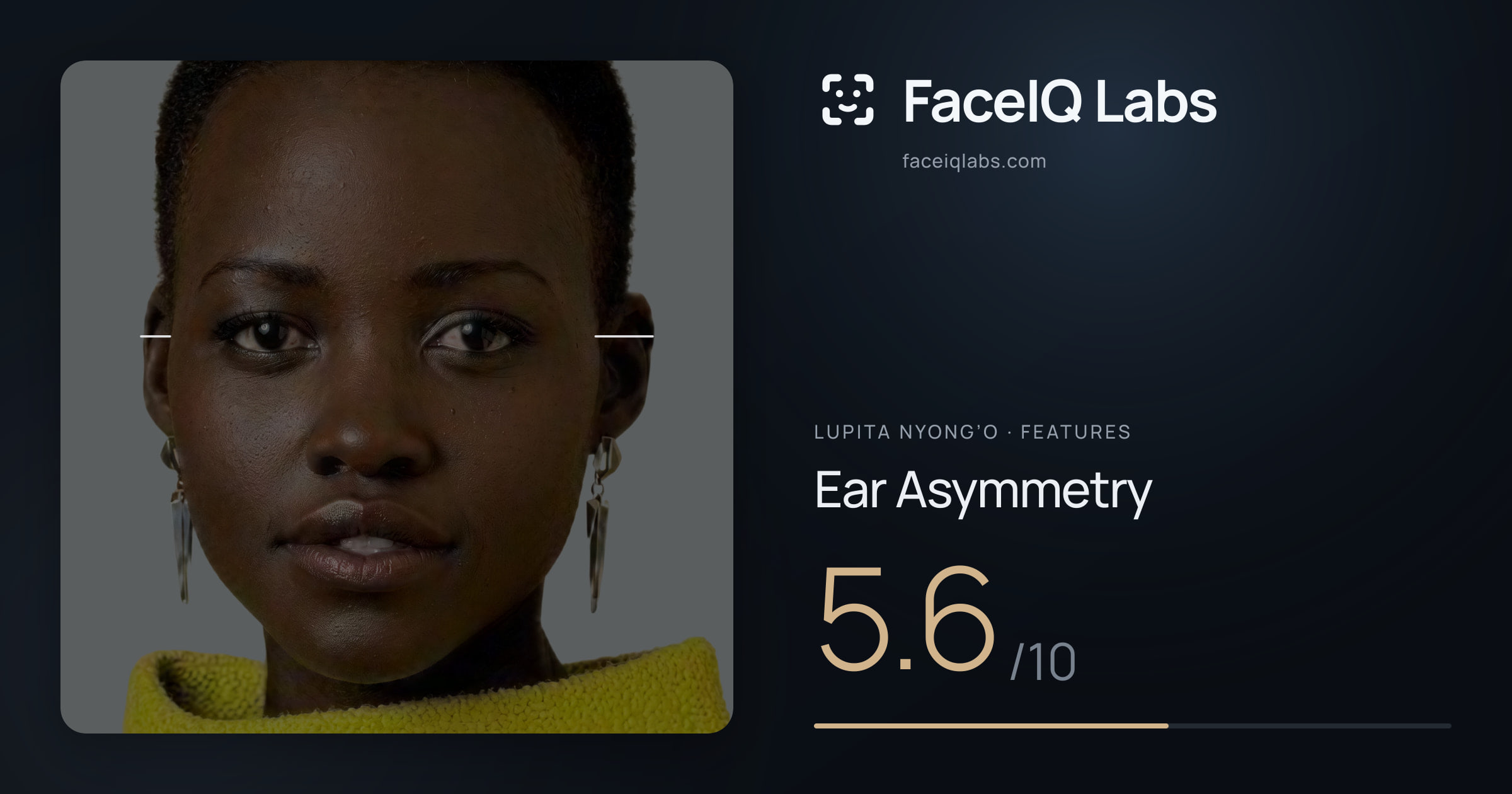 Lupita Nyong’o Ear Asymmetry: 5.6/10, drawn on the photo