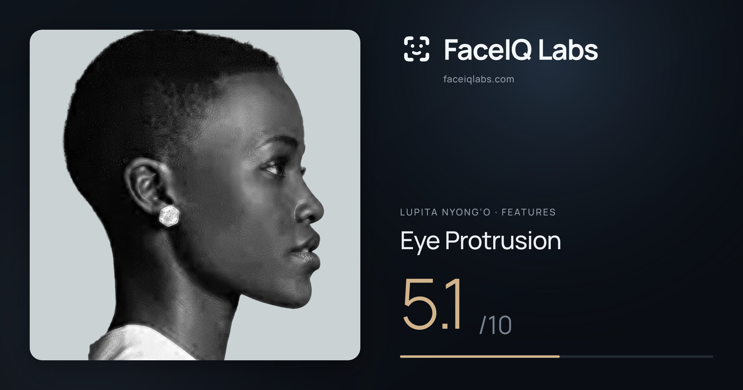 Lupita Nyong’o Eye Protrusion: 8.2/10, drawn on the photo