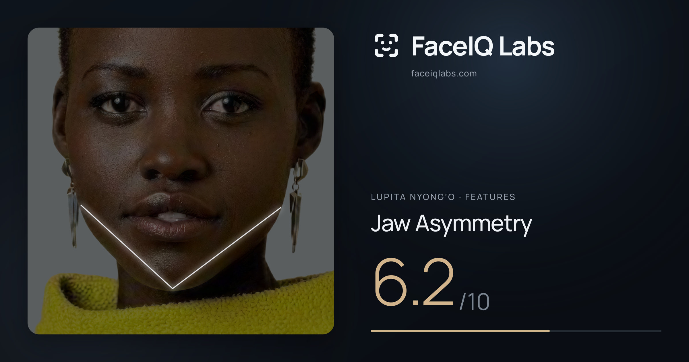 Lupita Nyong’o Jaw Asymmetry: 6.2/10, drawn on the photo
