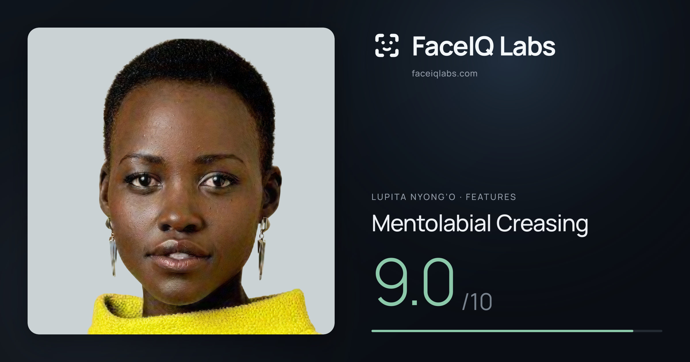 Lupita Nyong’o Mentolabial Creasing: 9.0/10, drawn on the photo