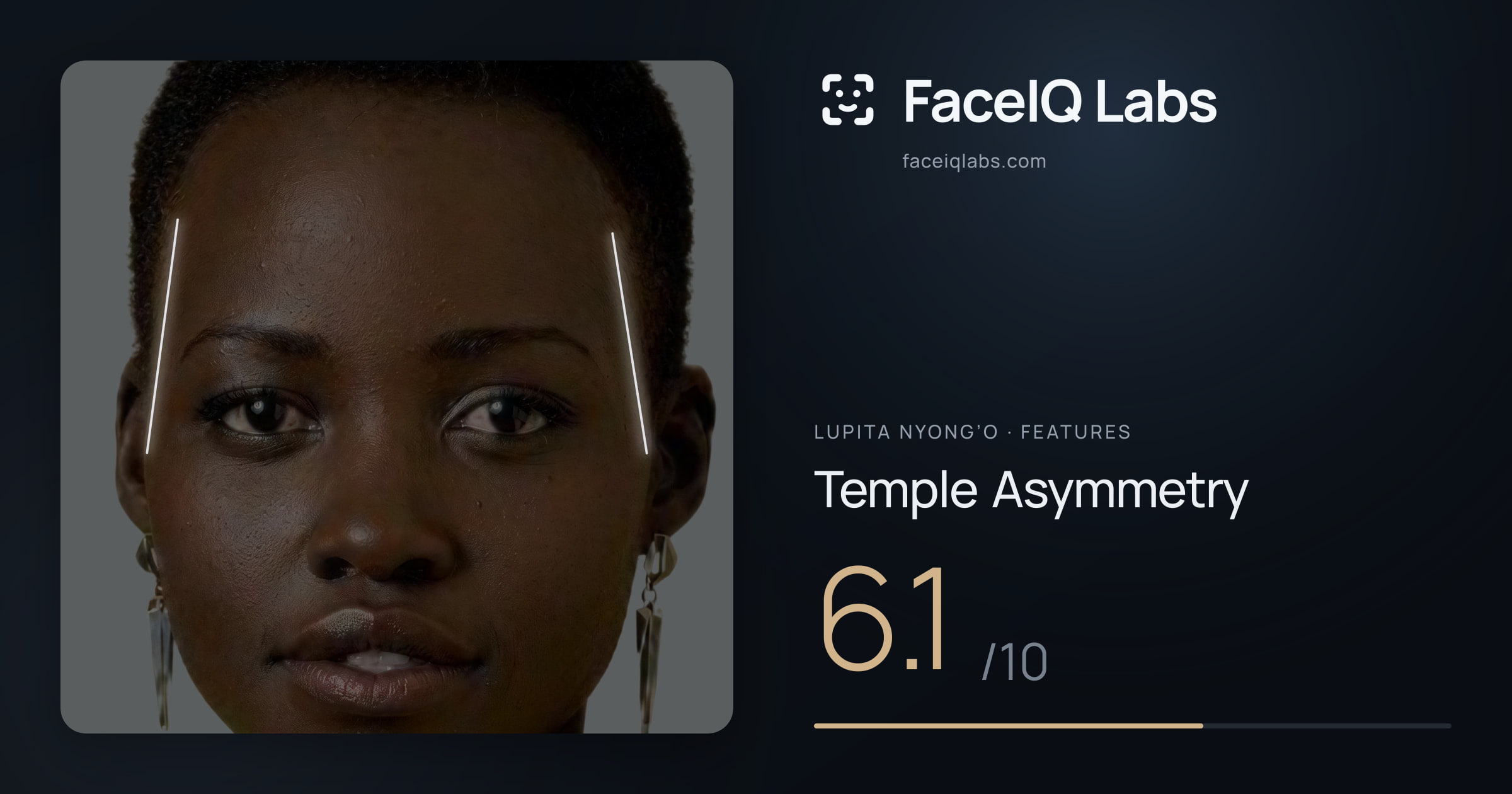 Lupita Nyong’o Temple Asymmetry: 6.1/10, drawn on the photo