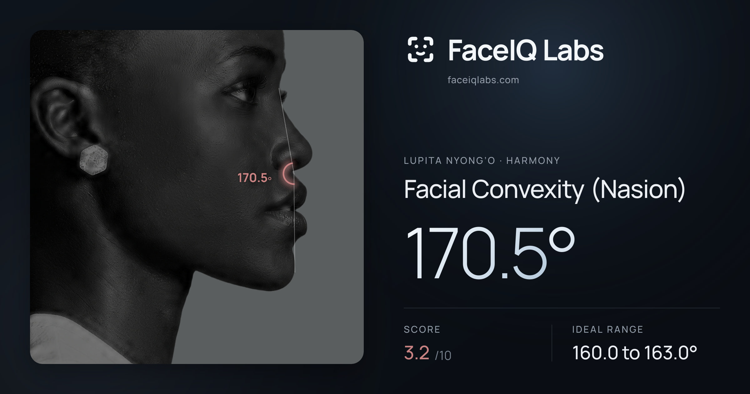 Lupita Nyong’o Facial Convexity (Nasion): 170.5°, drawn on the photo