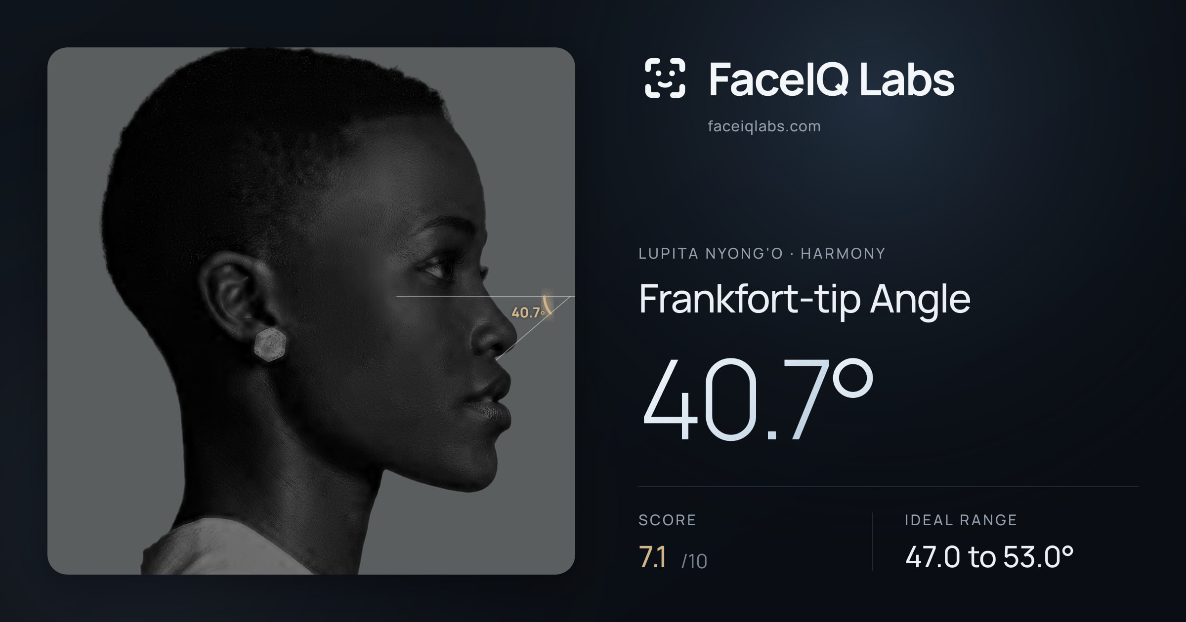 Lupita Nyong’o Frankfort-tip Angle: 40.7°, drawn on the photo
