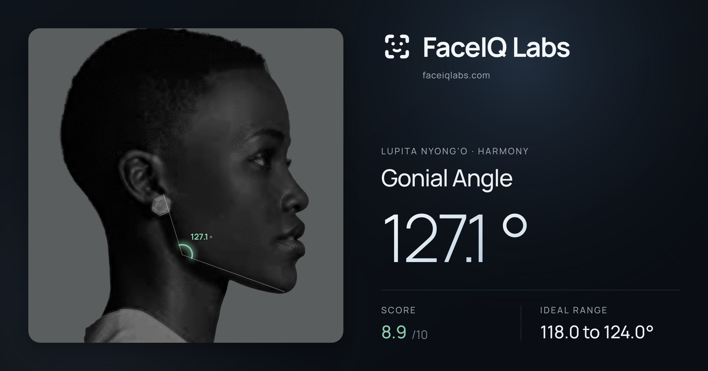 Lupita Nyong’o Gonial Angle: 127.1°, drawn on the photo