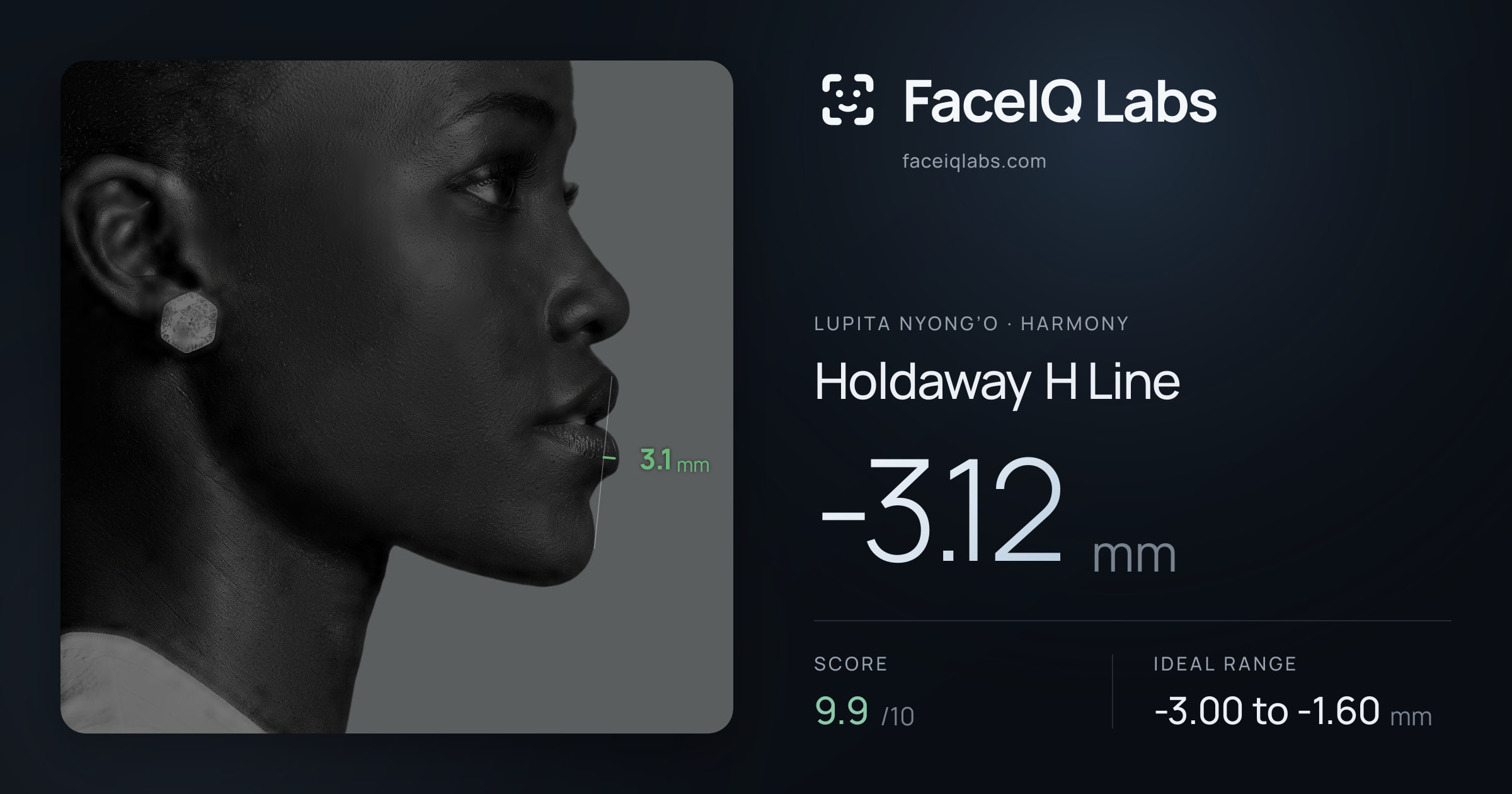 Lupita Nyong’o Holdaway H Line: -3.12mm, drawn on the photo