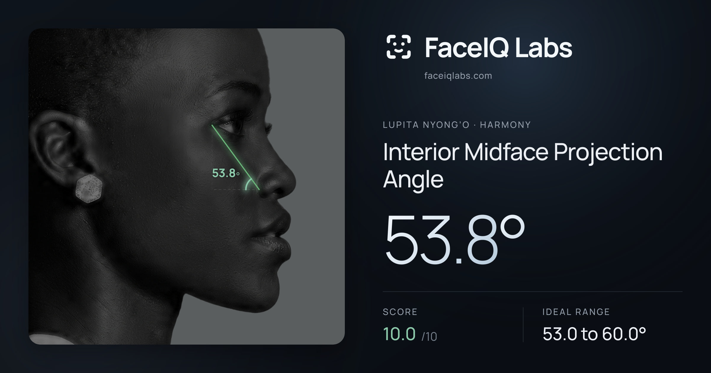 Lupita Nyong’o Interior Midface Projection Angle: 53.8°, drawn on the photo