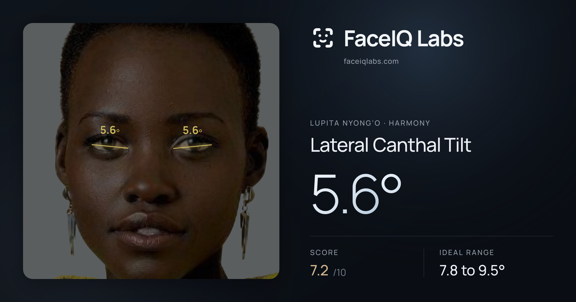 Lupita Nyong’o Lateral Canthal Tilt: 5.6°, drawn on the photo