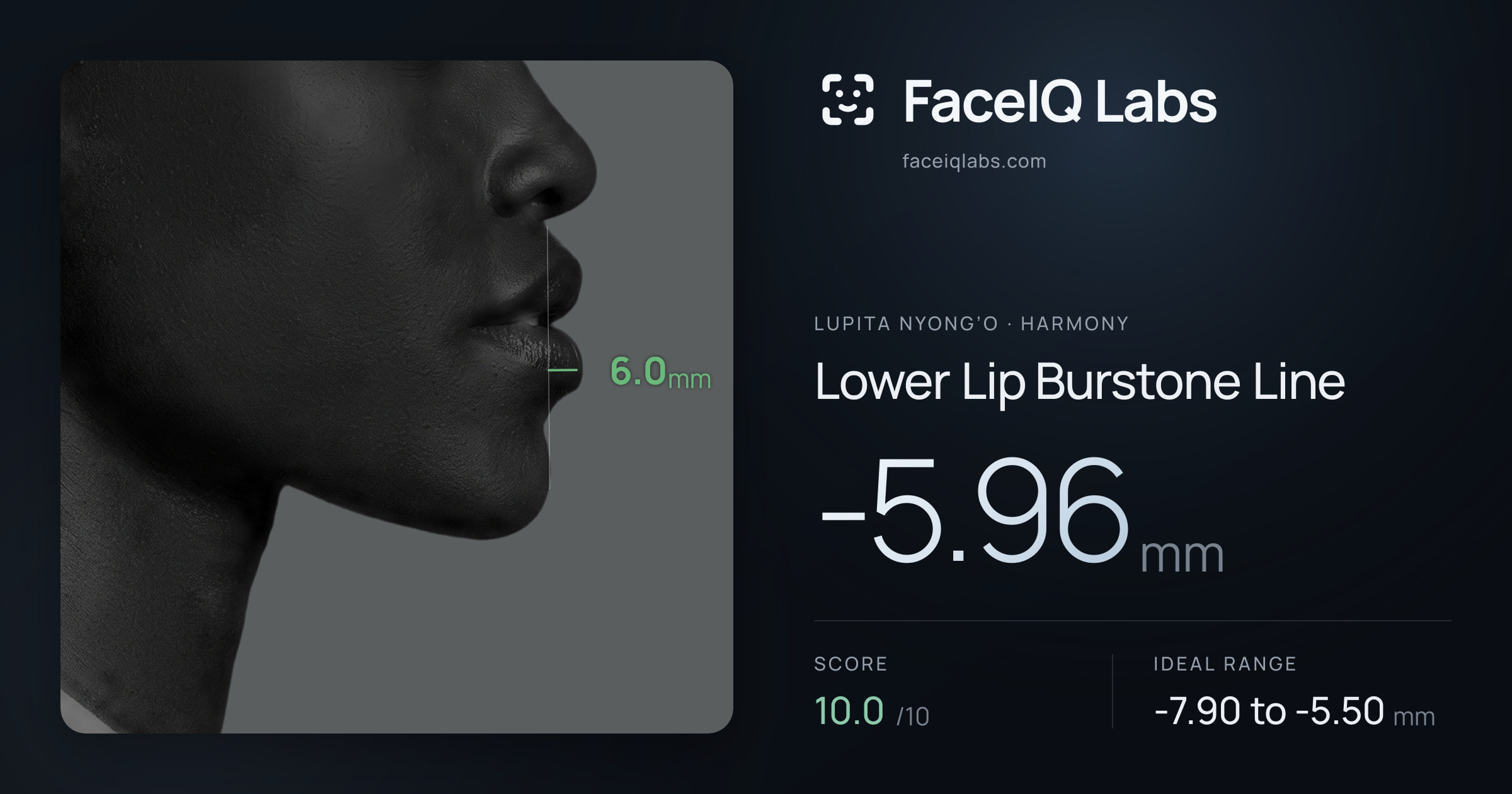 Lupita Nyong’o Lower Lip Burstone Line: -5.96mm, drawn on the photo