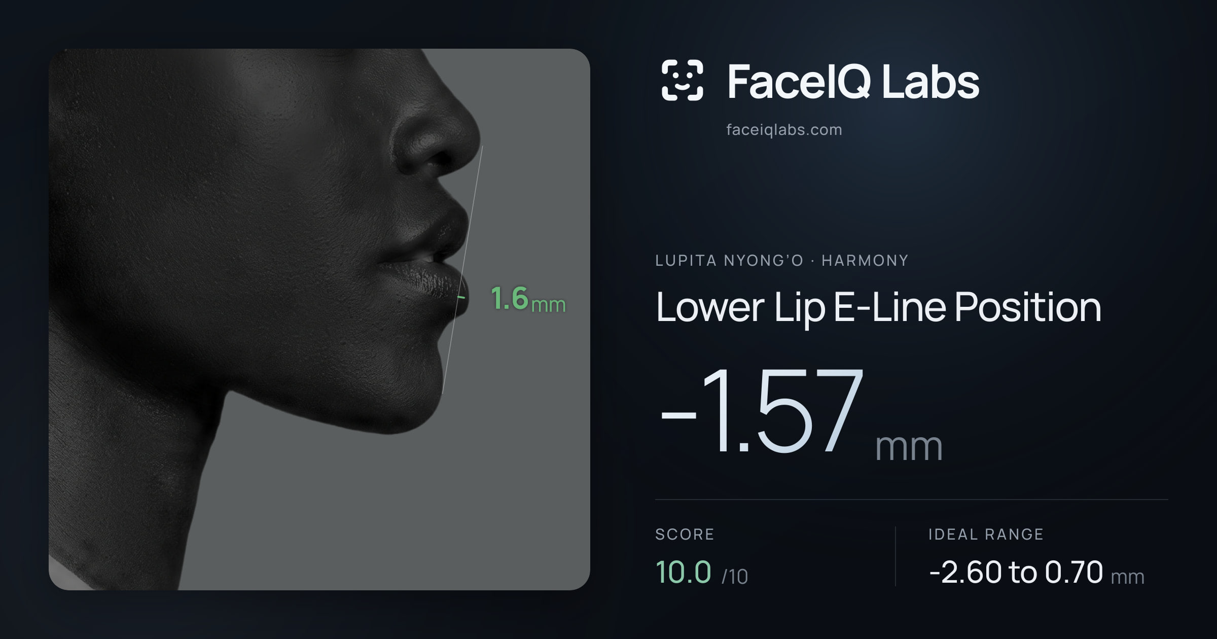 Lupita Nyong’o Lower Lip E-Line Position: -1.57mm, drawn on the photo