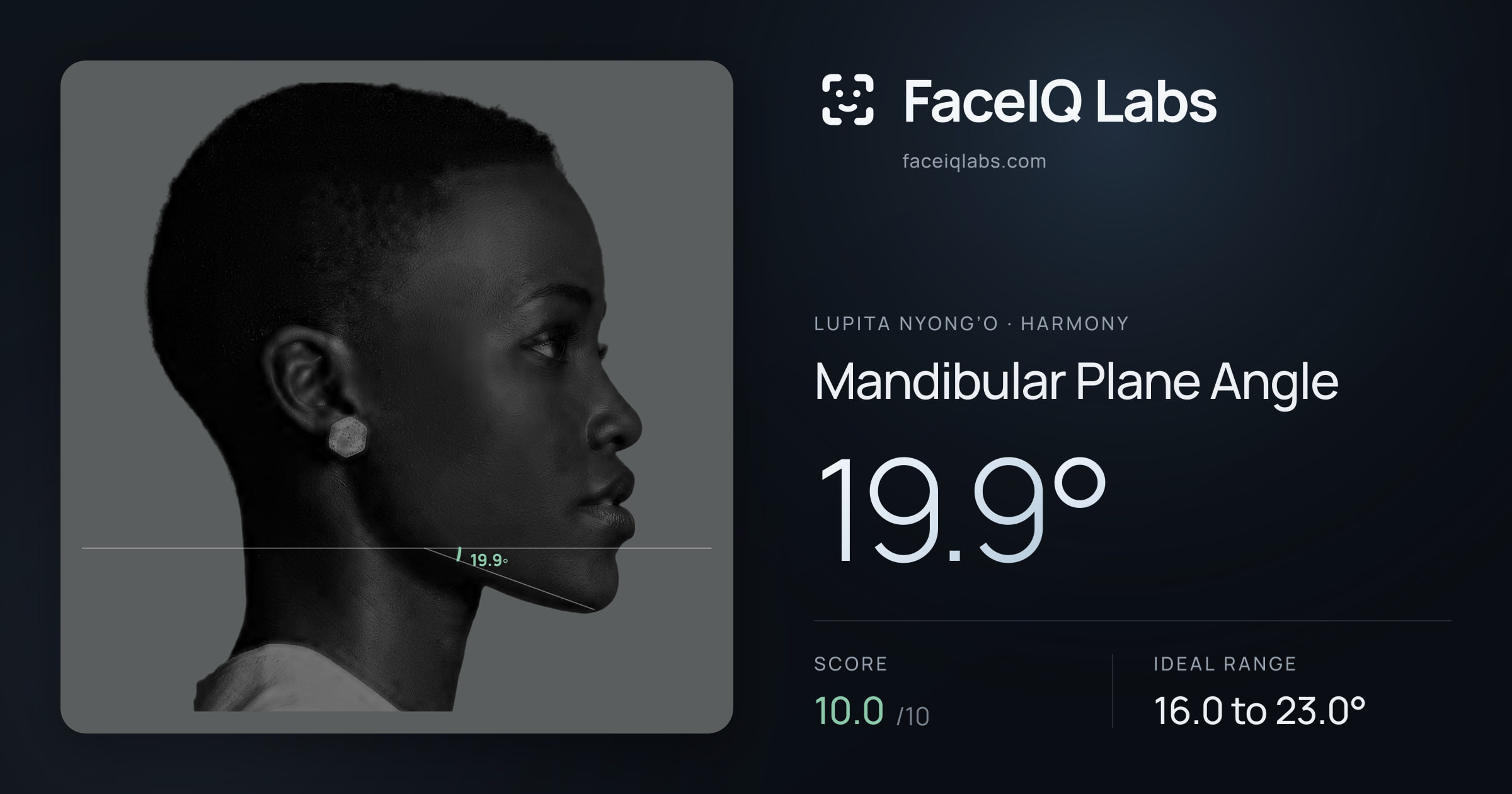 Lupita Nyong’o Mandibular Plane Angle: 19.9°, drawn on the photo