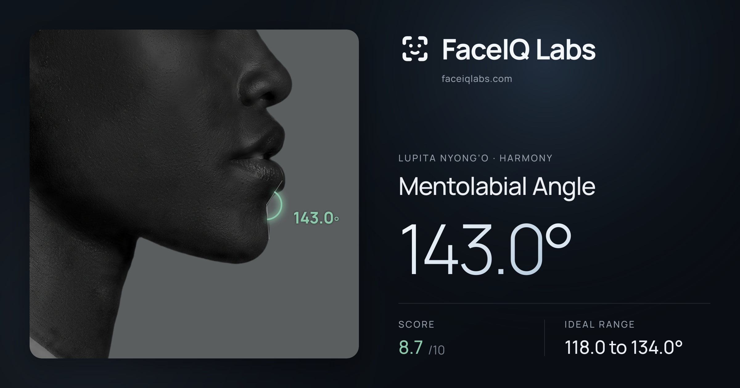 Lupita Nyong’o Mentolabial Angle: 143.0°, drawn on the photo