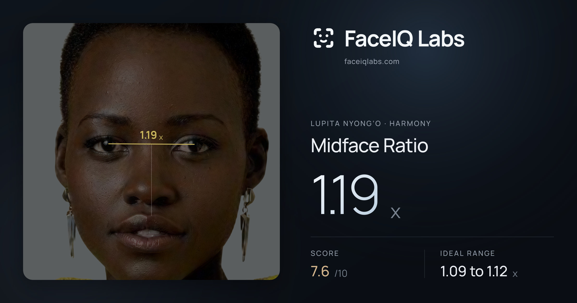 Lupita Nyong’o Midface Ratio: 1.19x, drawn on the photo