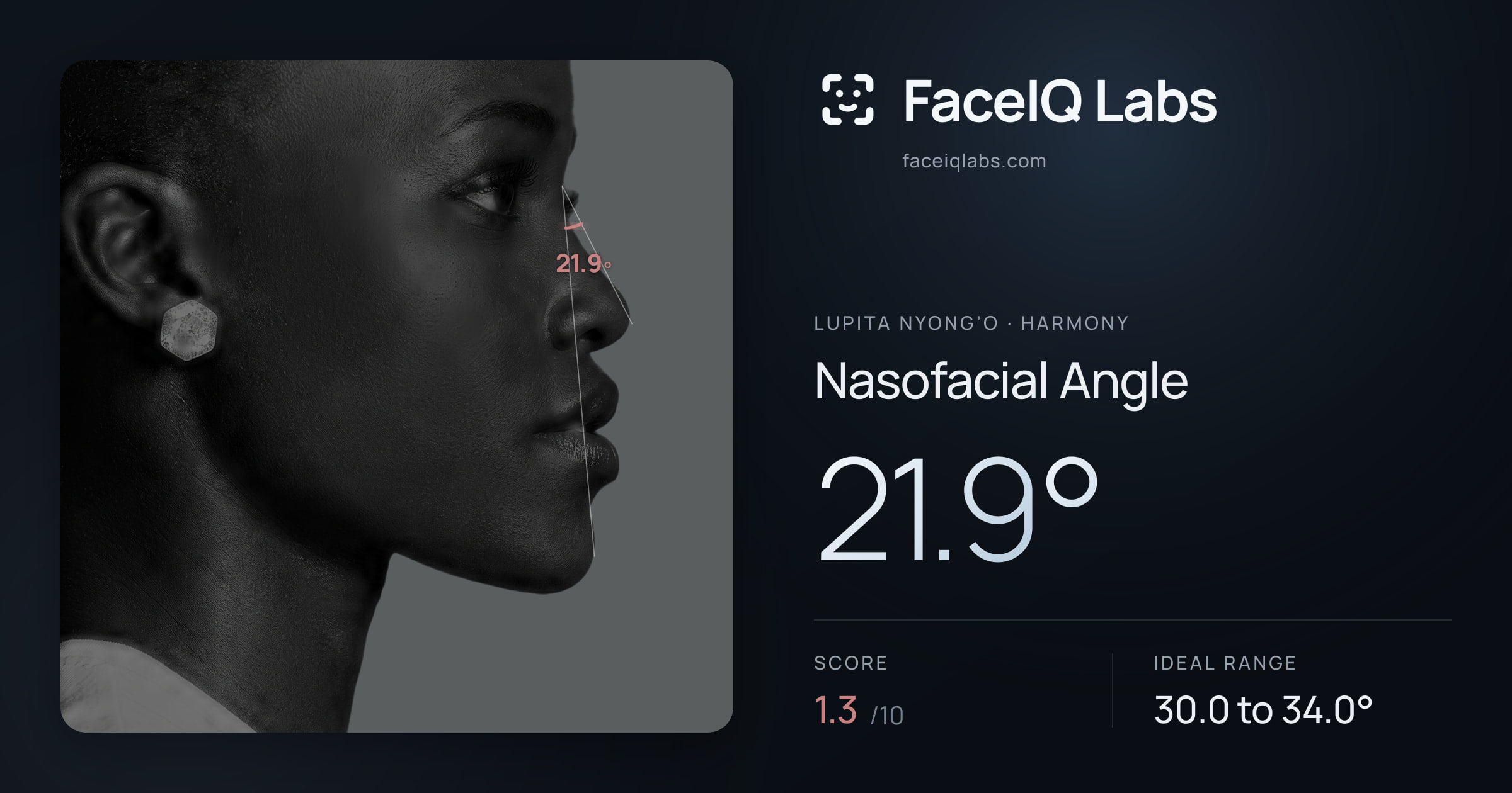 Lupita Nyong’o Nasofacial Angle: 21.9°, drawn on the photo