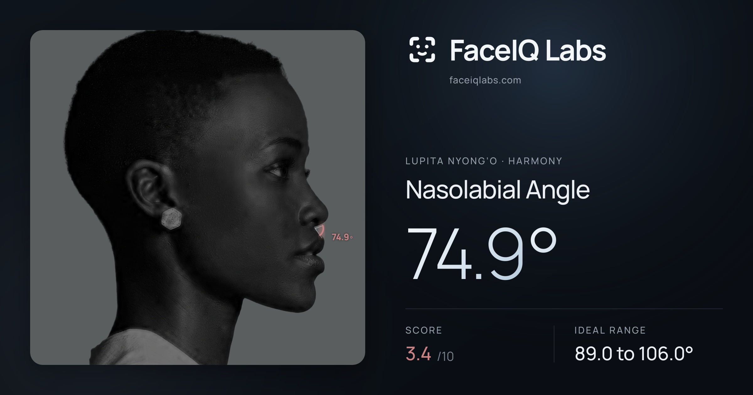 Lupita Nyong’o Nasolabial Angle: 74.9°, drawn on the photo