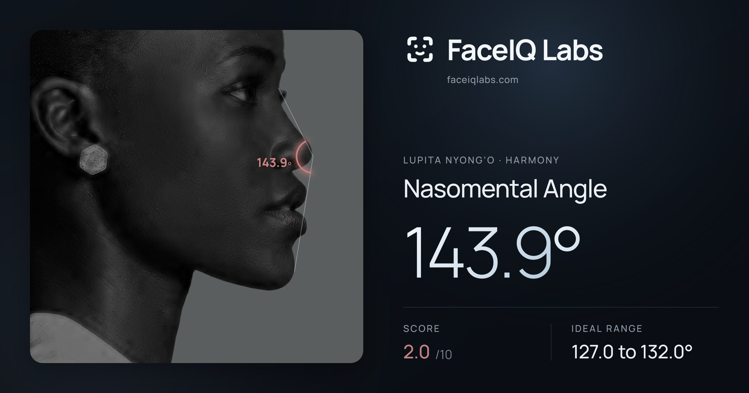 Lupita Nyong’o Nasomental Angle: 143.9°, drawn on the photo