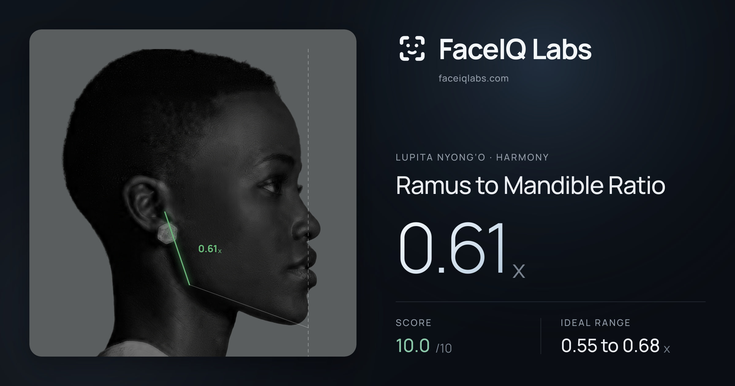 Lupita Nyong’o Ramus to Mandible Ratio: 0.61x, drawn on the photo