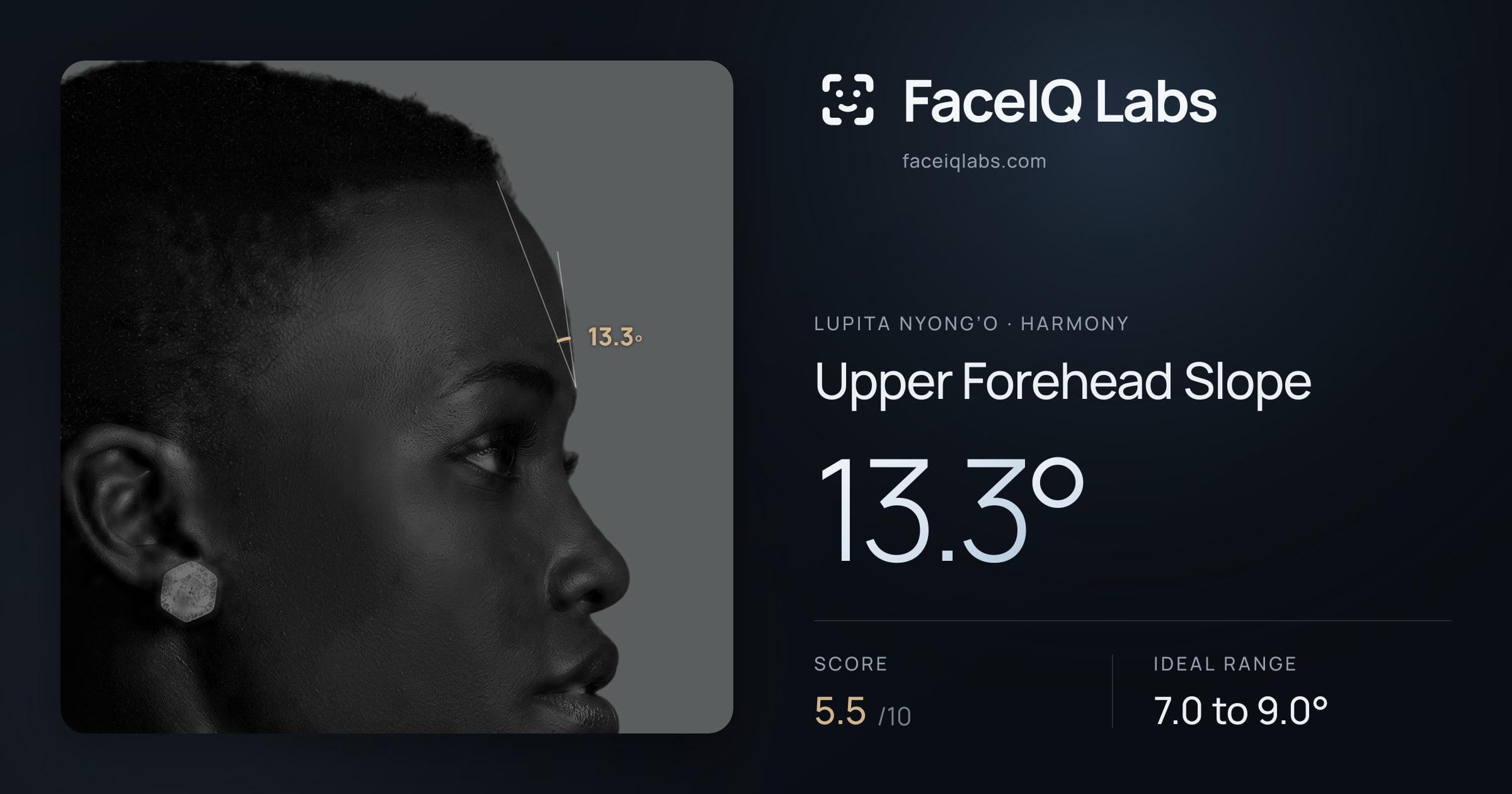 Lupita Nyong’o Upper Forehead Slope: 13.3°, drawn on the photo
