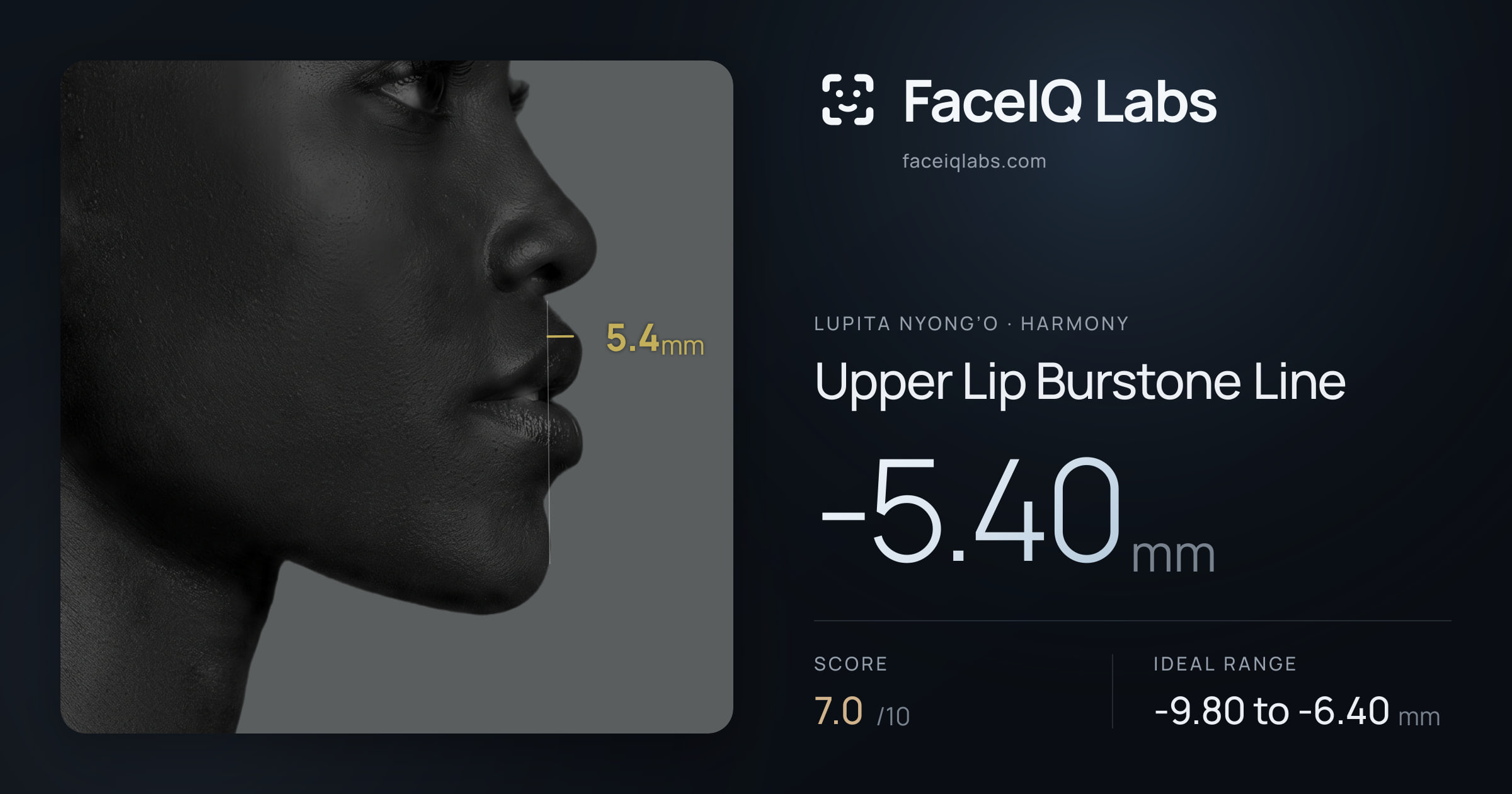 Lupita Nyong’o Upper Lip Burstone Line: -5.40mm, drawn on the photo