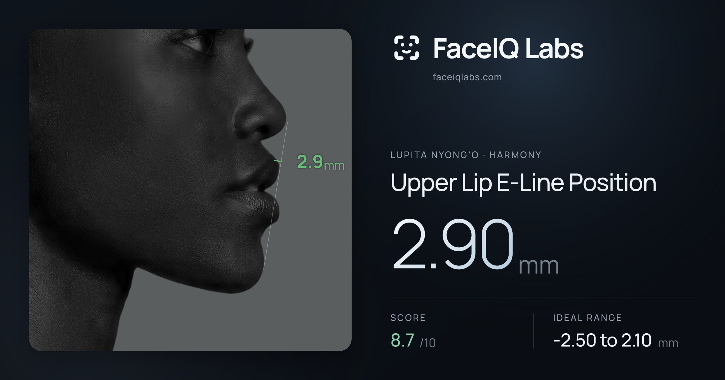Lupita Nyong’o Upper Lip E-Line Position: 2.90mm, drawn on the photo