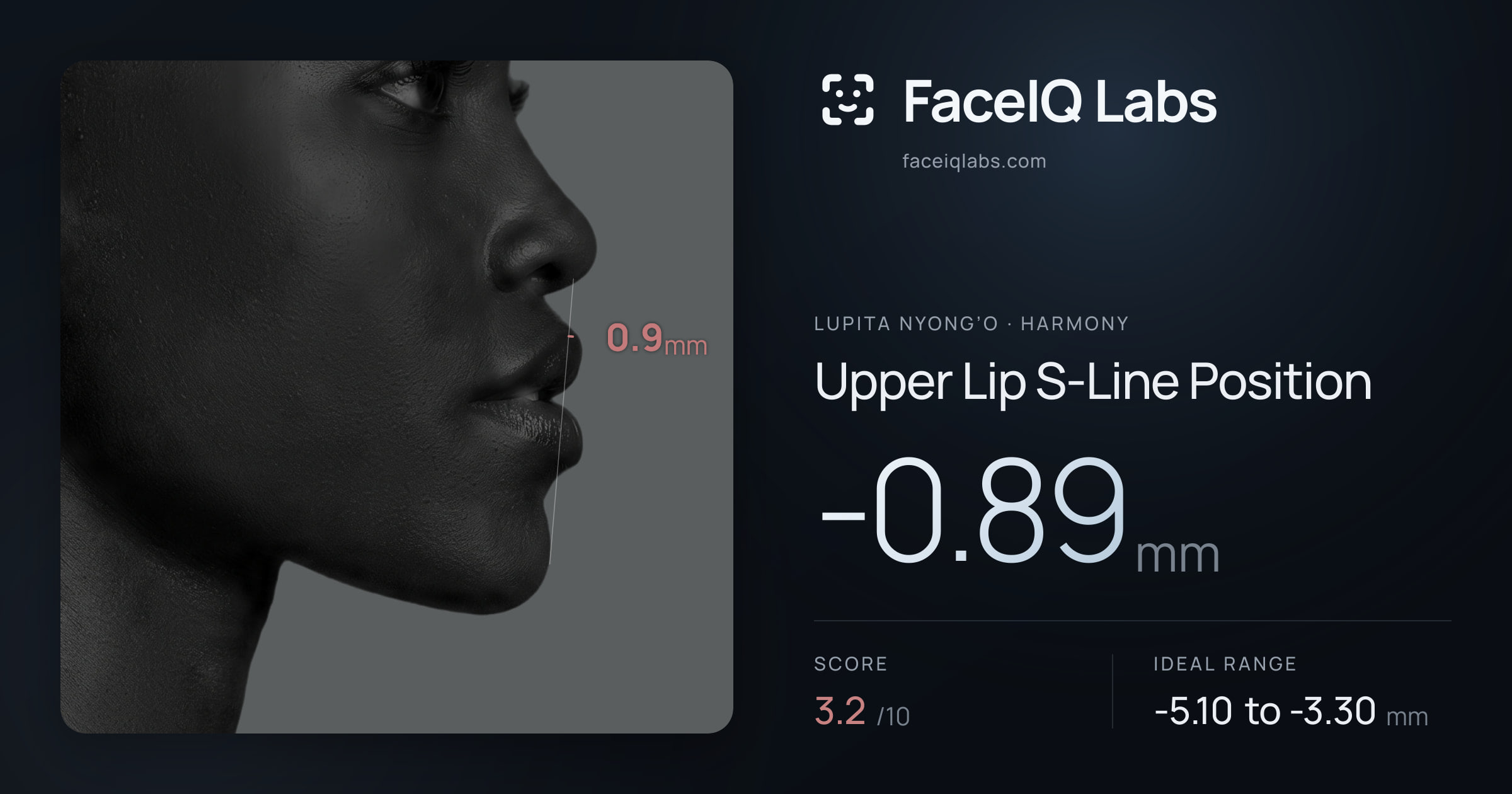 Lupita Nyong’o Upper Lip S-Line Position: -0.89mm, drawn on the photo