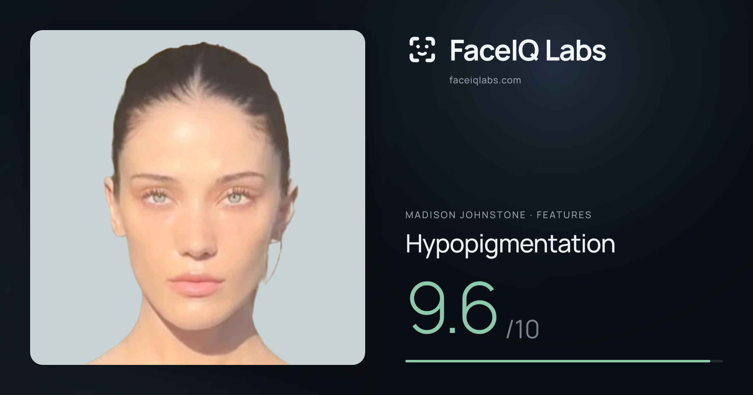 Madison Johnstone Hypopigmentation: 9.6/10, drawn on the photo