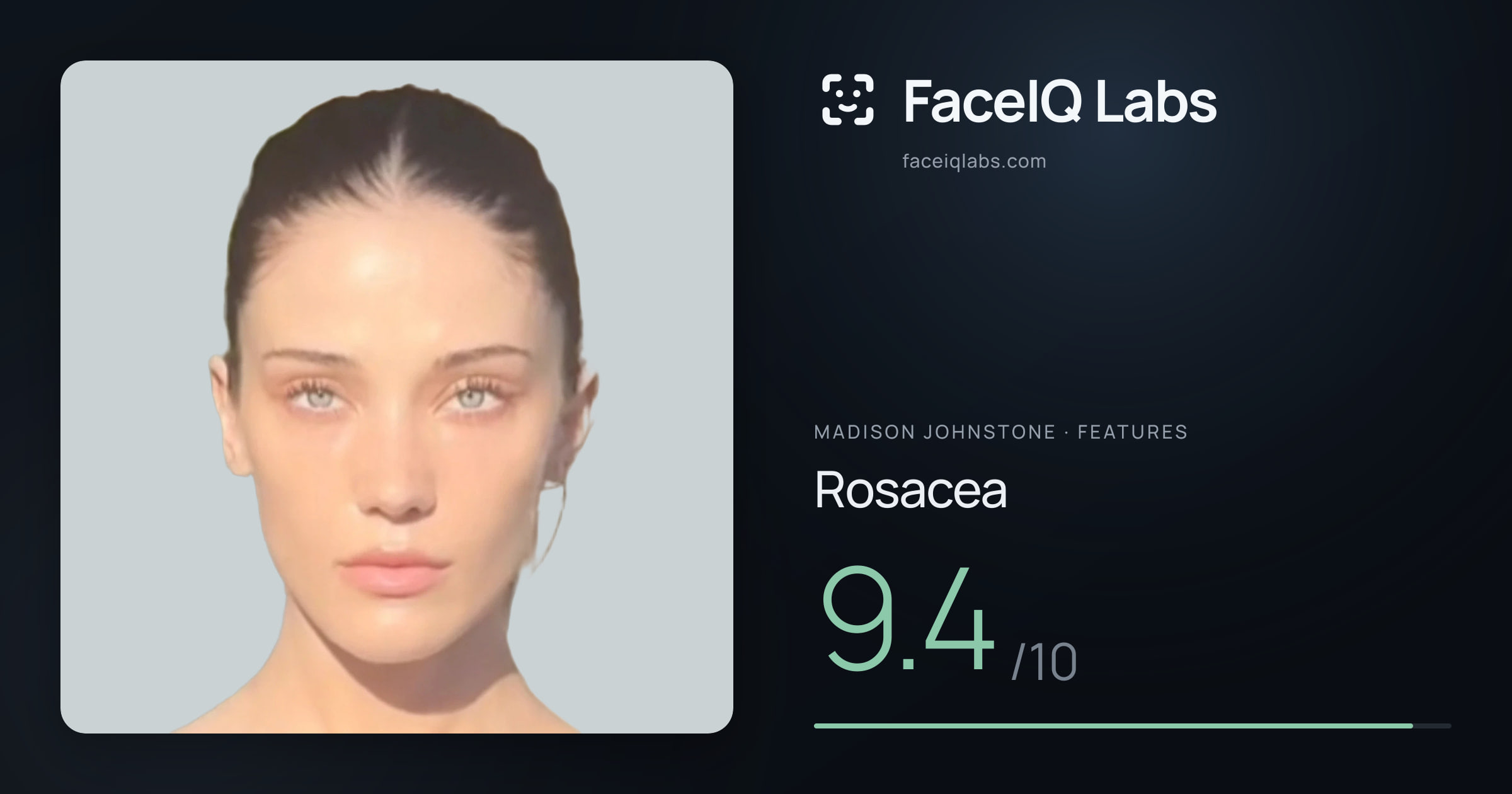 Madison Johnstone Rosacea: 9.4/10, drawn on the photo