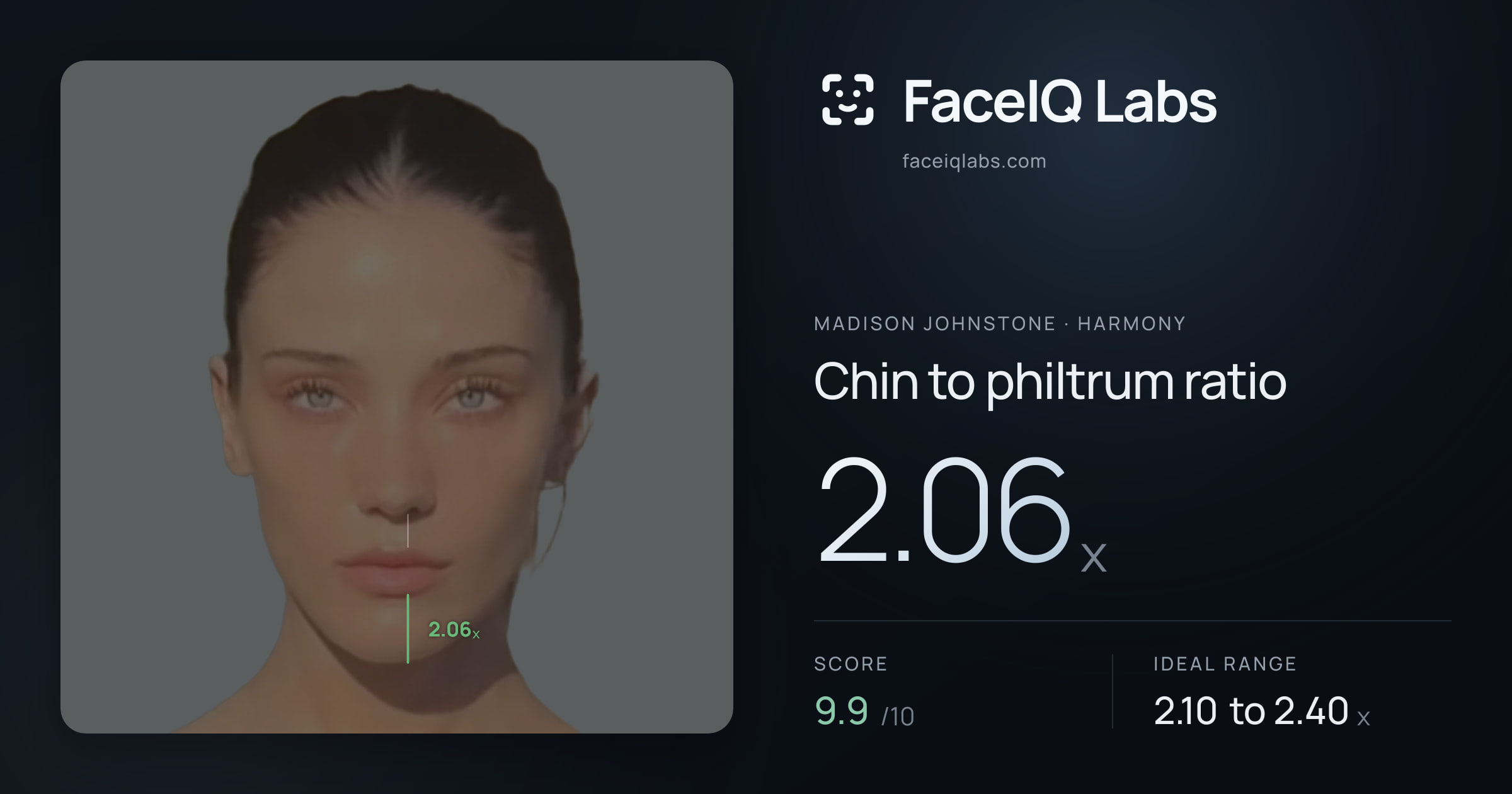 Madison Johnstone Chin to philtrum ratio: 2.06x, drawn on the photo