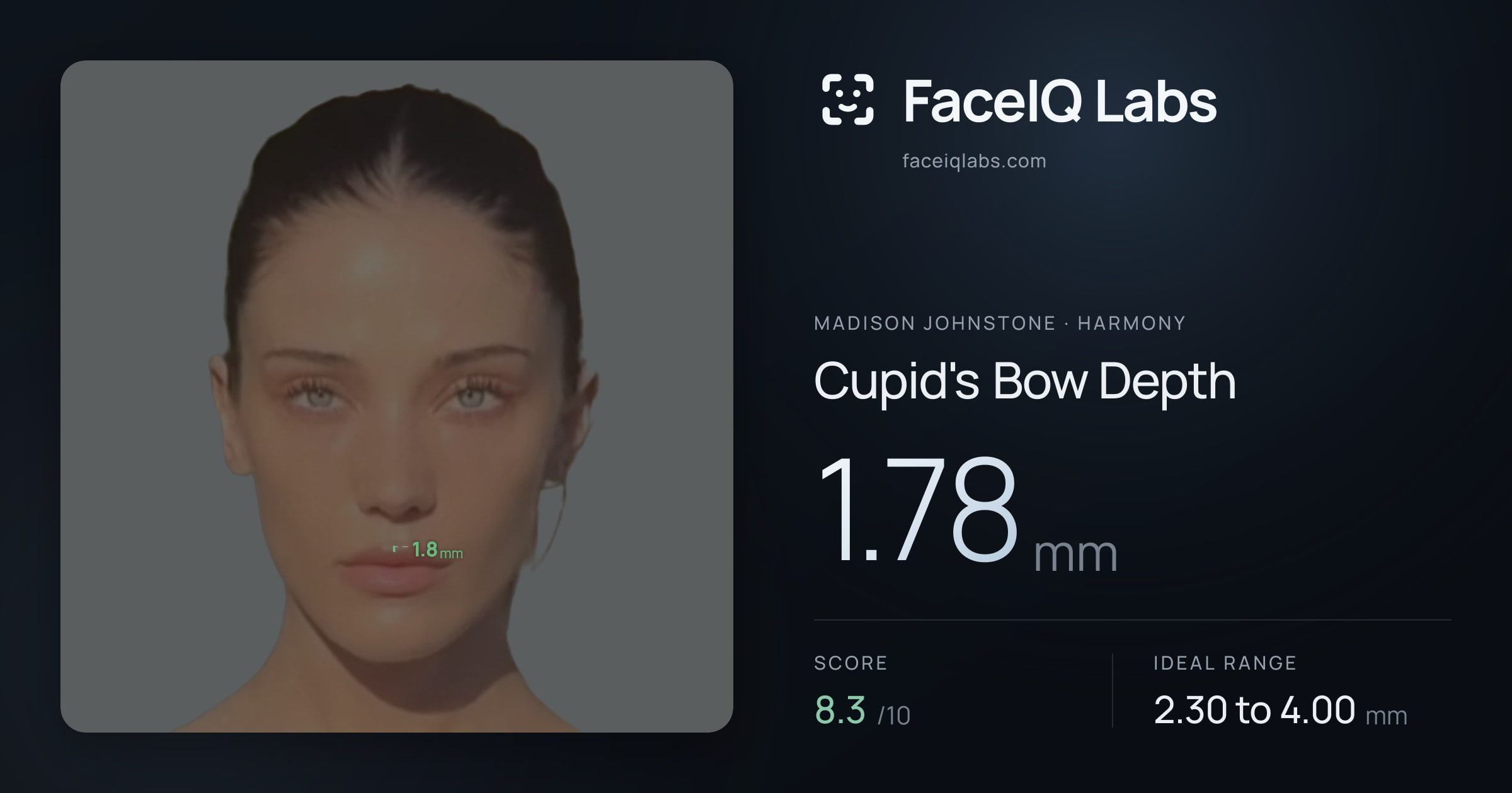 Madison Johnstone Cupid's Bow Depth: 1.78mm, drawn on the photo