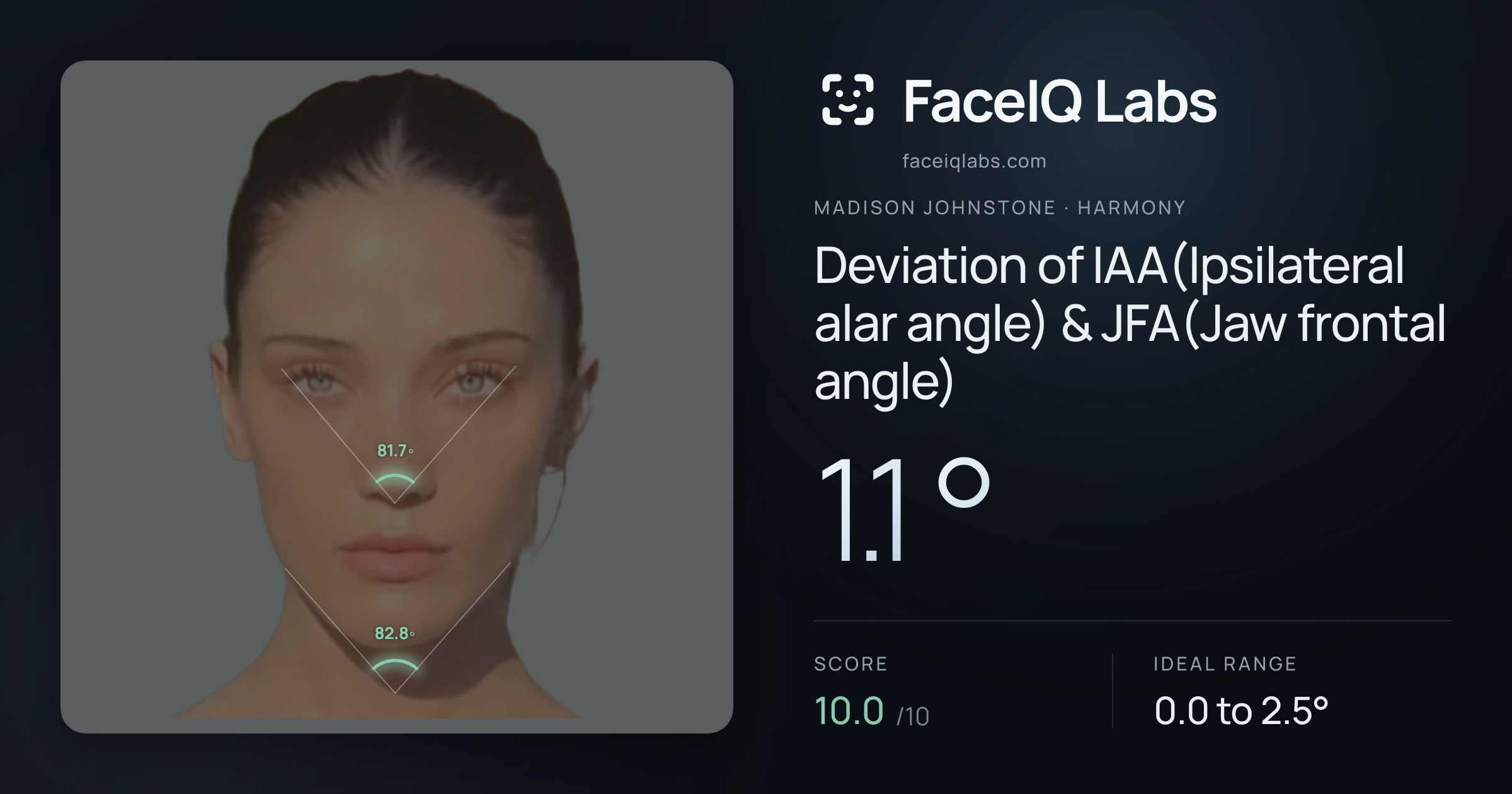 Madison Johnstone Deviation of IAA(Ipsilateral alar angle) & JFA(Jaw frontal angle): 1.1°, drawn on the photo