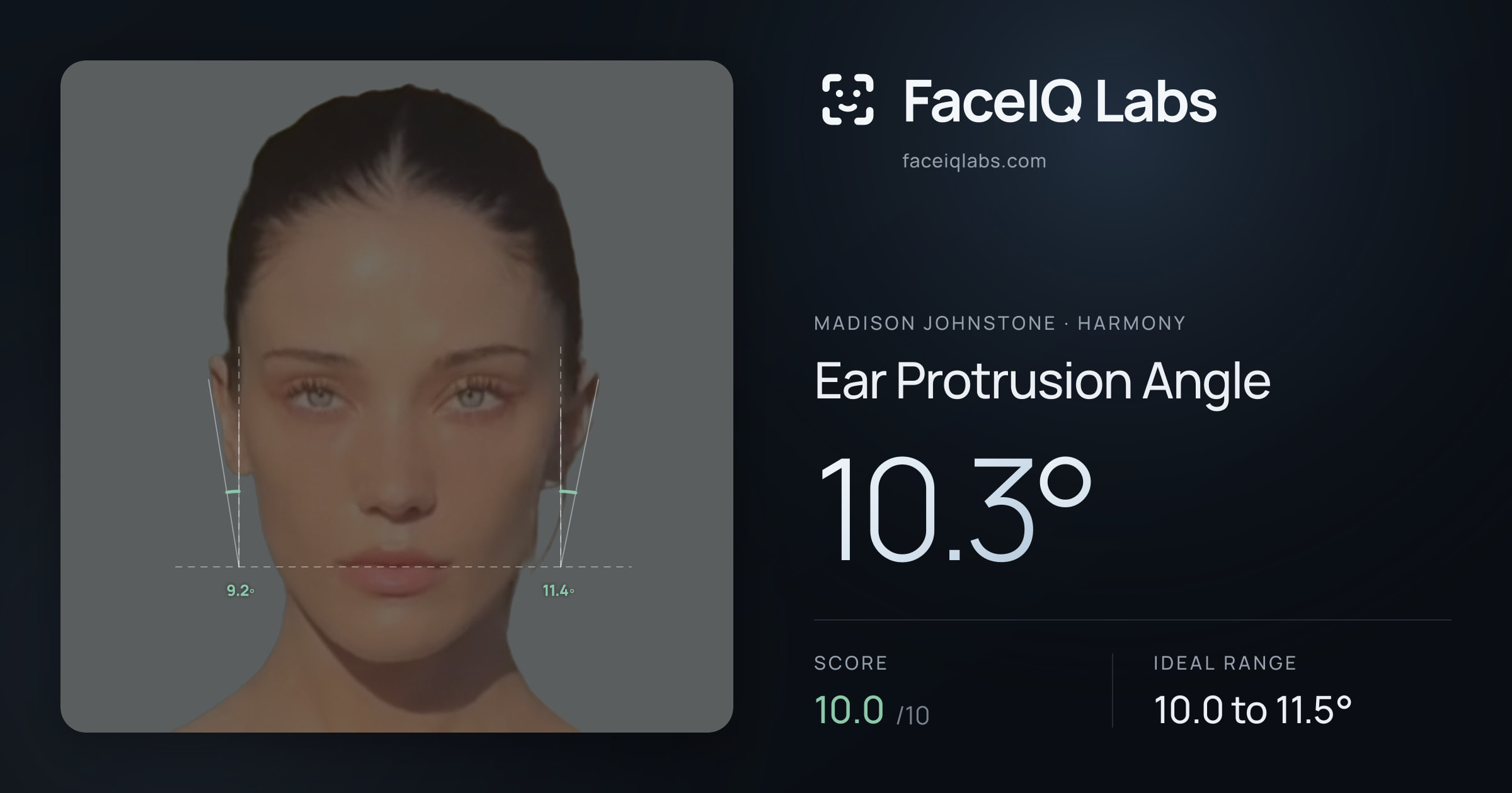 Madison Johnstone Ear Protrusion Angle: 10.3°, drawn on the photo