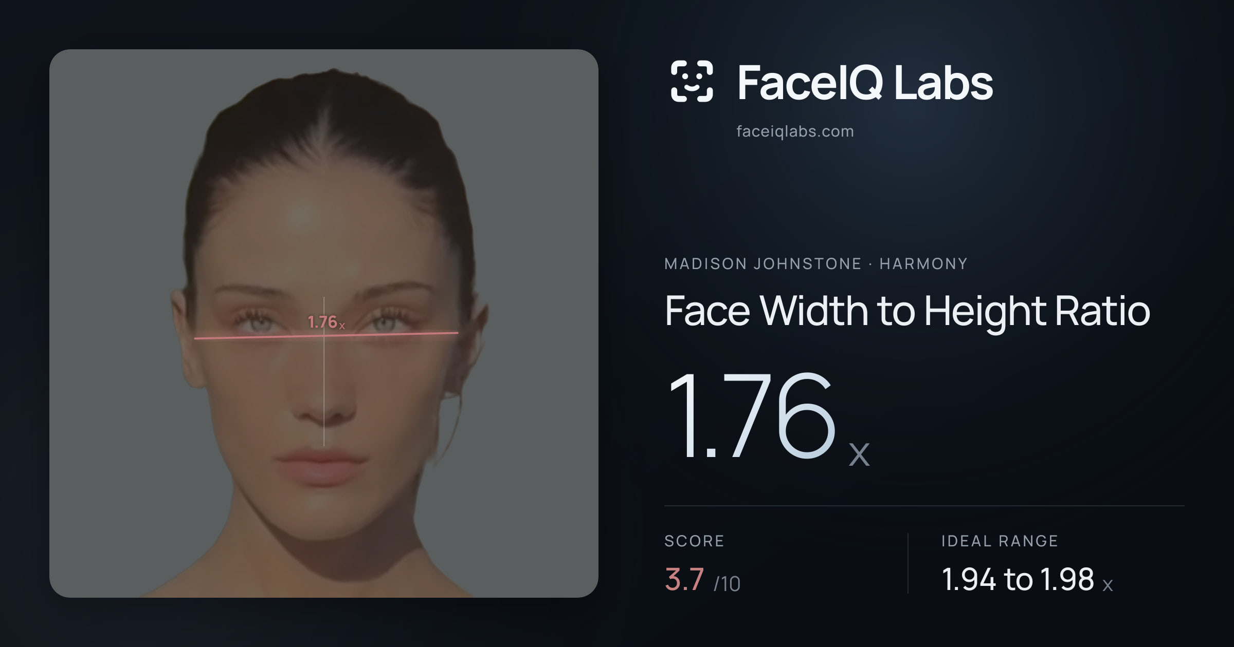 Madison Johnstone Face Width to Height Ratio: 1.76x, drawn on the photo