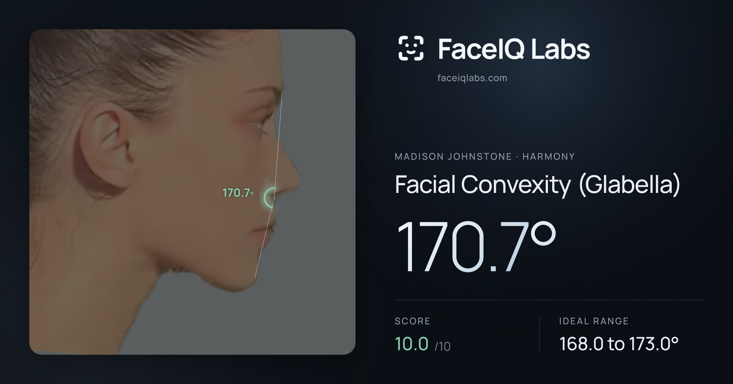 Madison Johnstone Facial Convexity (Glabella): 170.7°, drawn on the photo