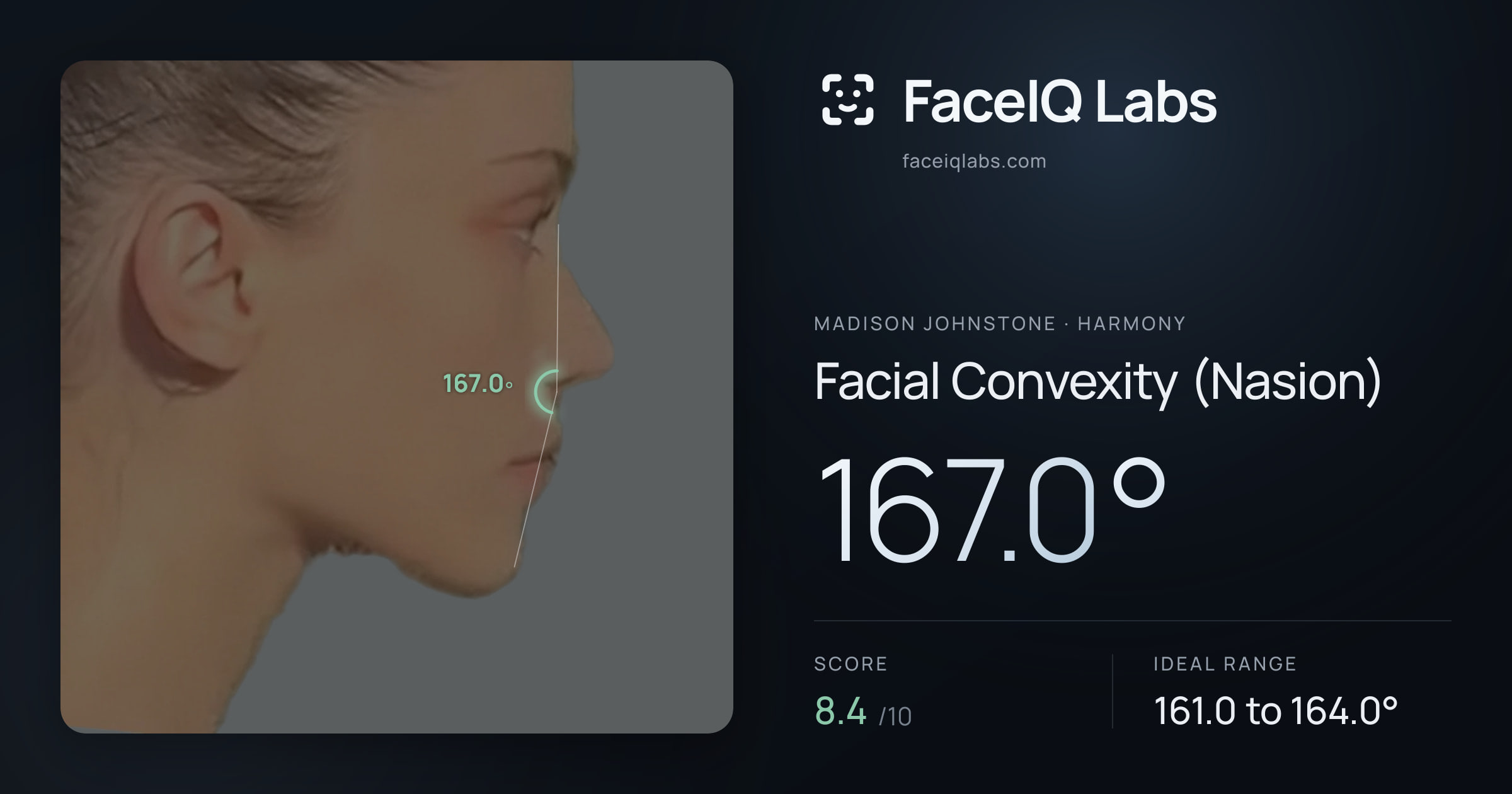 Madison Johnstone Facial Convexity (Nasion): 167.0°, drawn on the photo