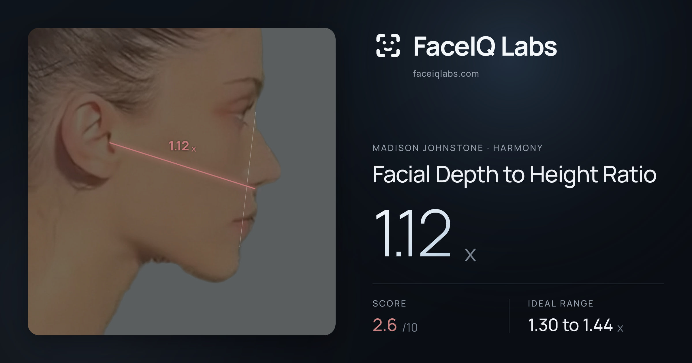 Madison Johnstone Facial Depth to Height Ratio: 1.12x, drawn on the photo
