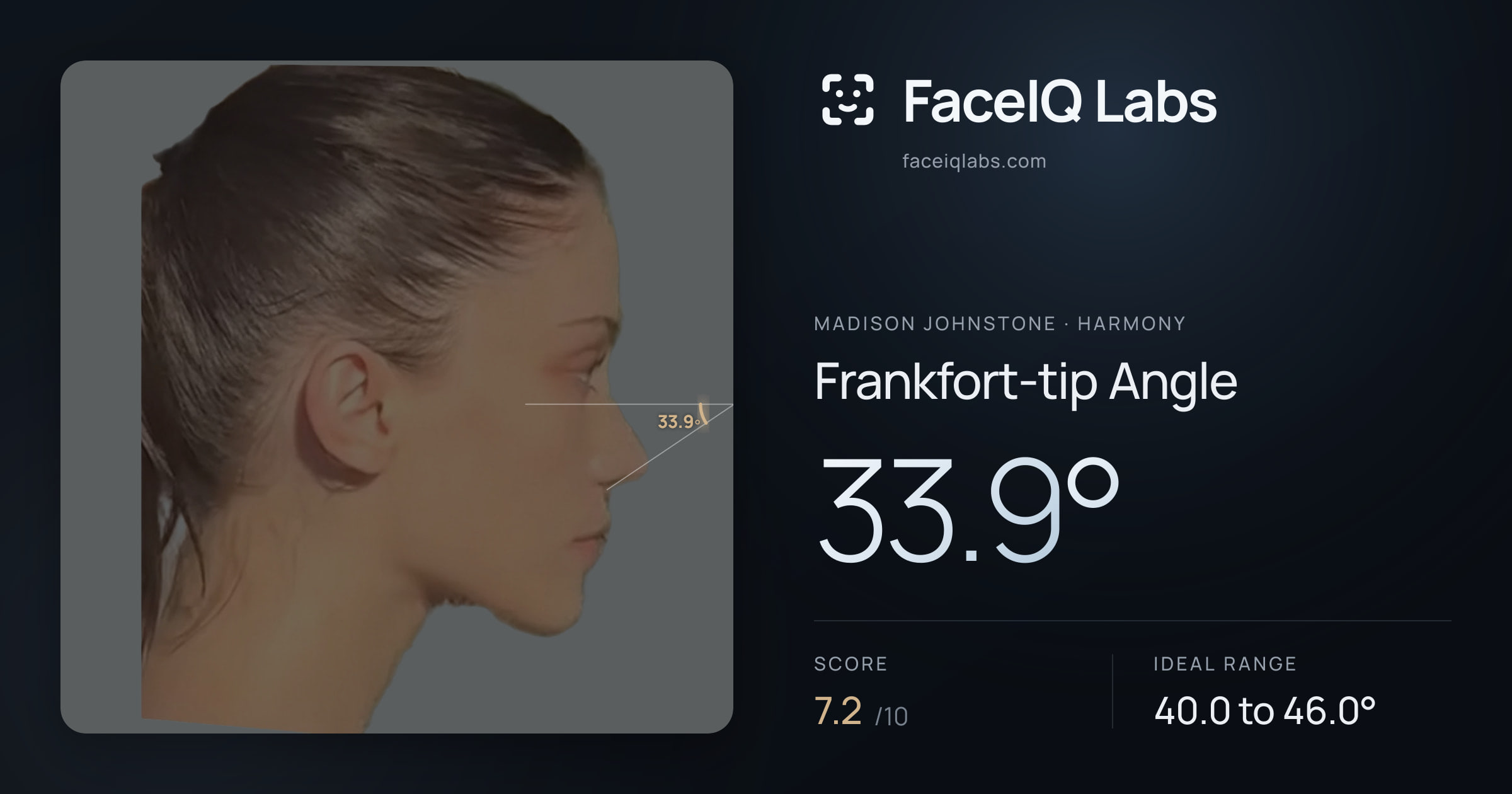 Madison Johnstone Frankfort-tip Angle: 33.9°, drawn on the photo