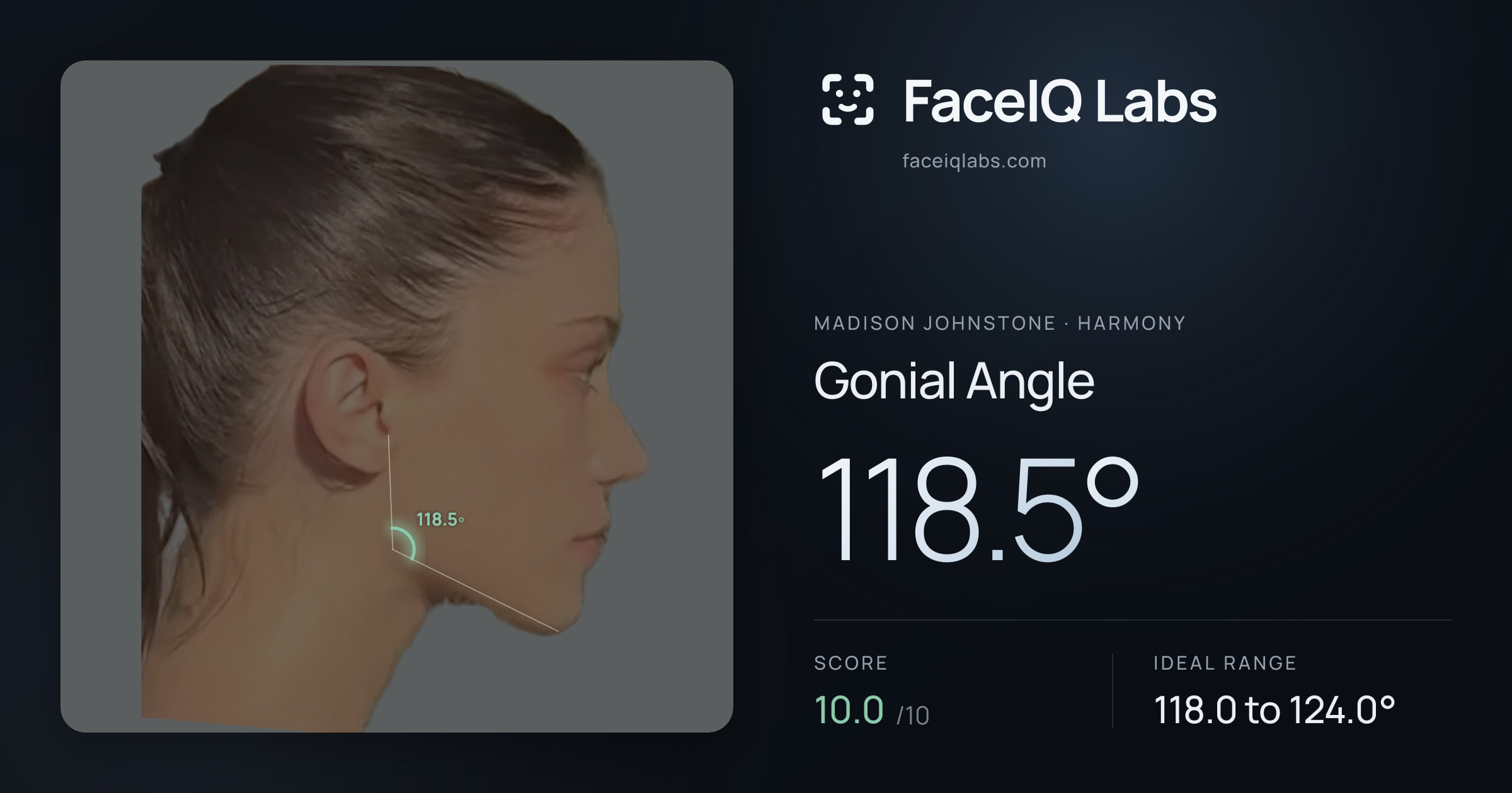 Madison Johnstone Gonial Angle: 118.5°, drawn on the photo