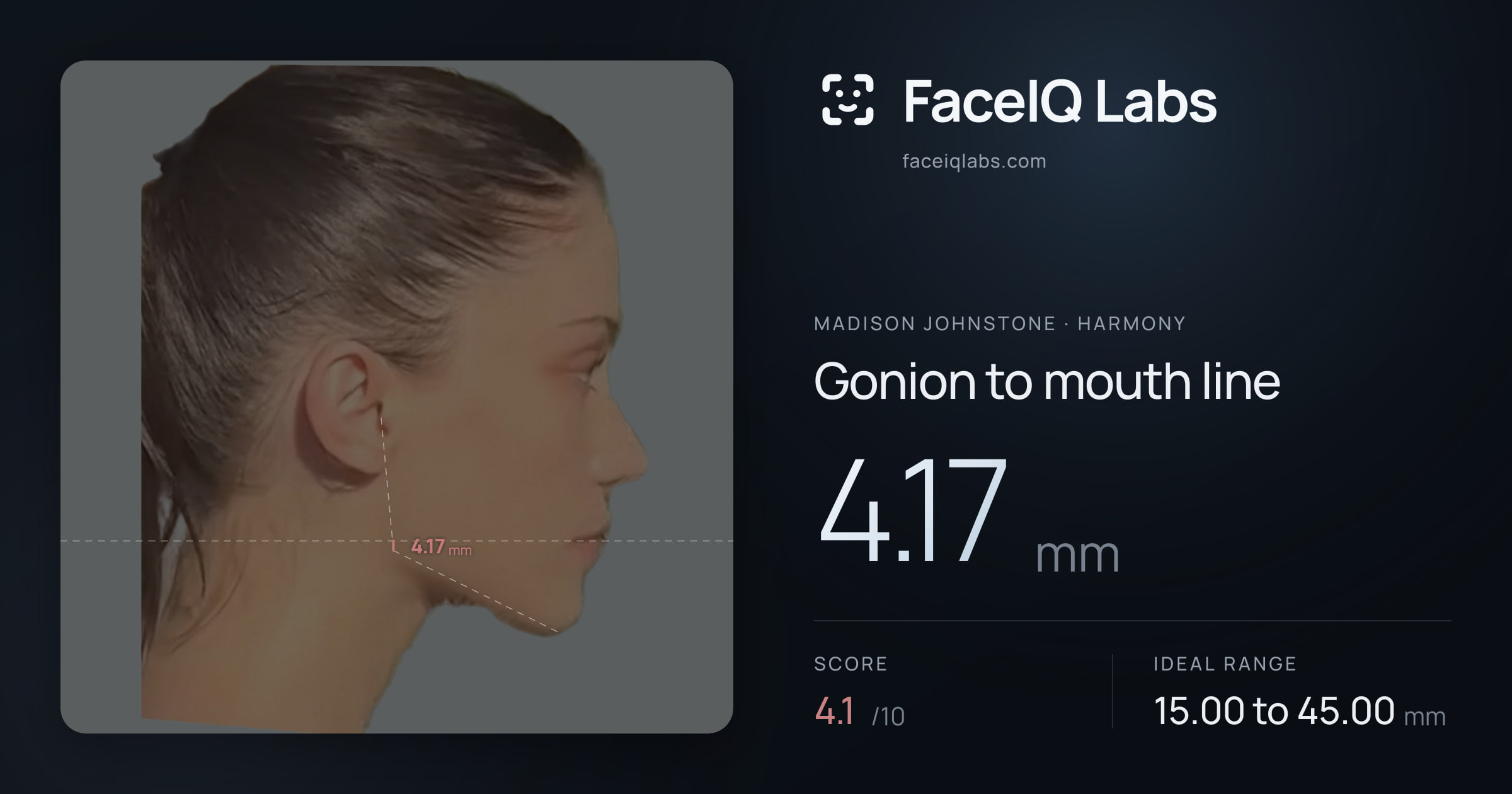 Madison Johnstone Gonion to mouth line: 4.17mm, drawn on the photo