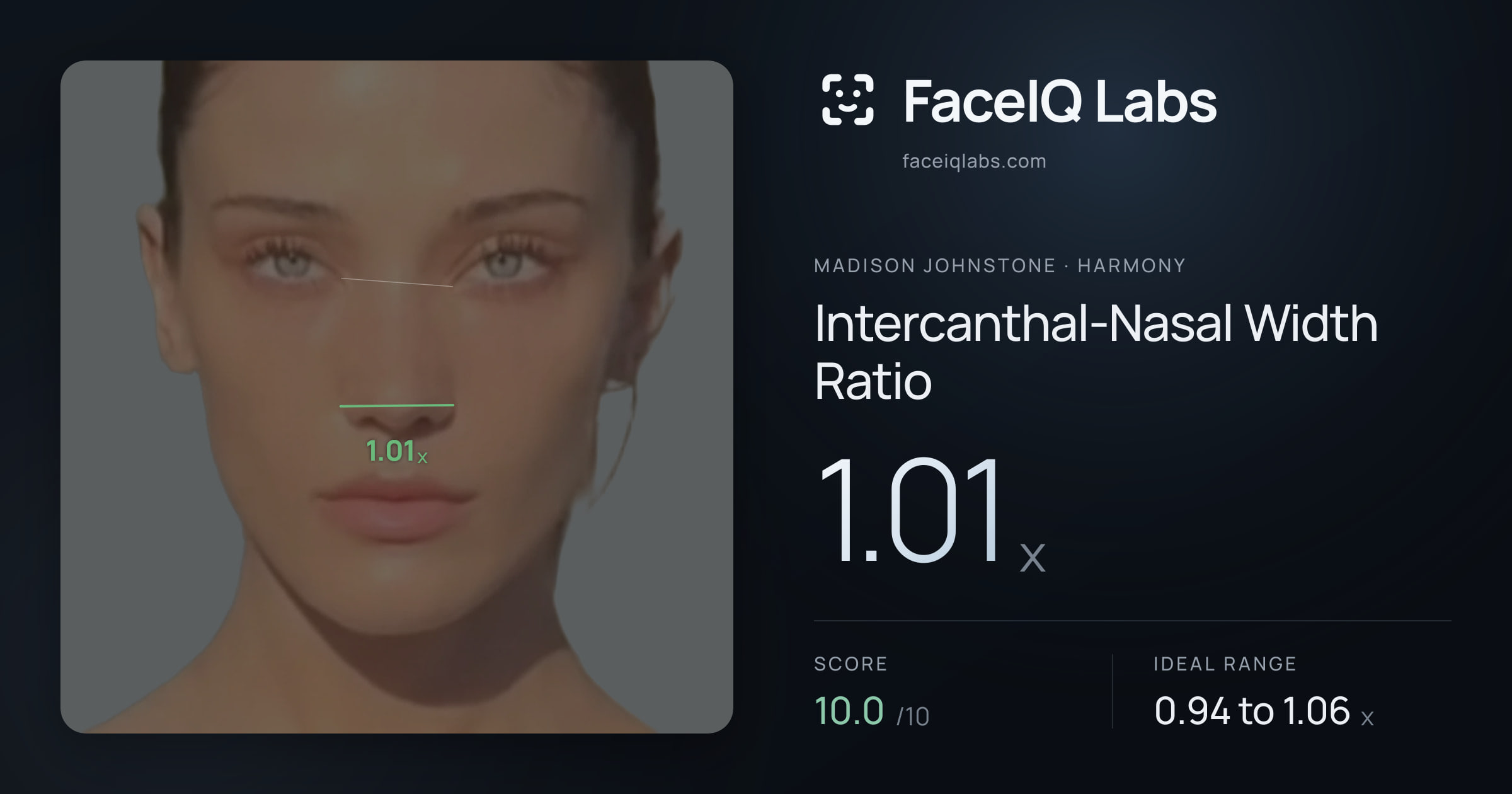 Madison Johnstone Intercanthal-Nasal Width Ratio: 1.01x, drawn on the photo