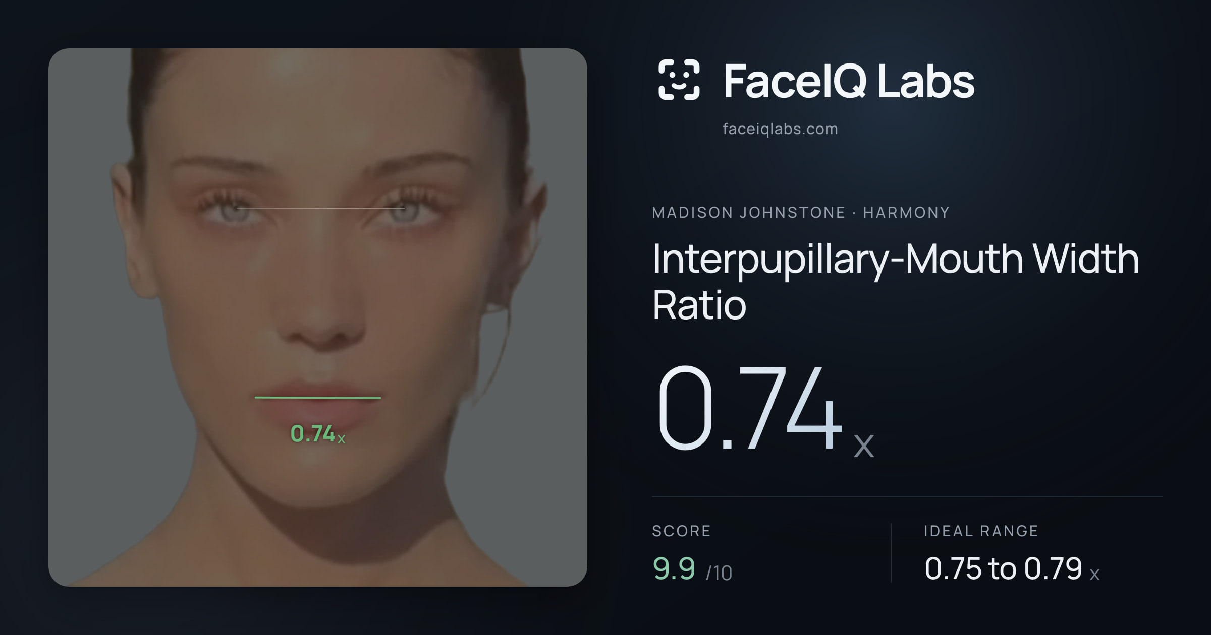 Madison Johnstone Interpupillary-Mouth Width Ratio: 0.74x, drawn on the photo