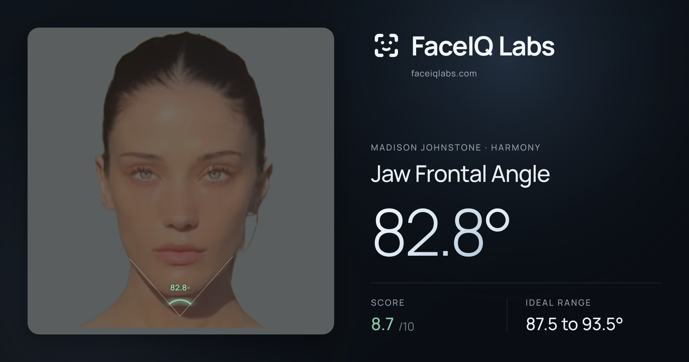 Madison Johnstone Jaw Frontal Angle: 82.8°, drawn on the photo