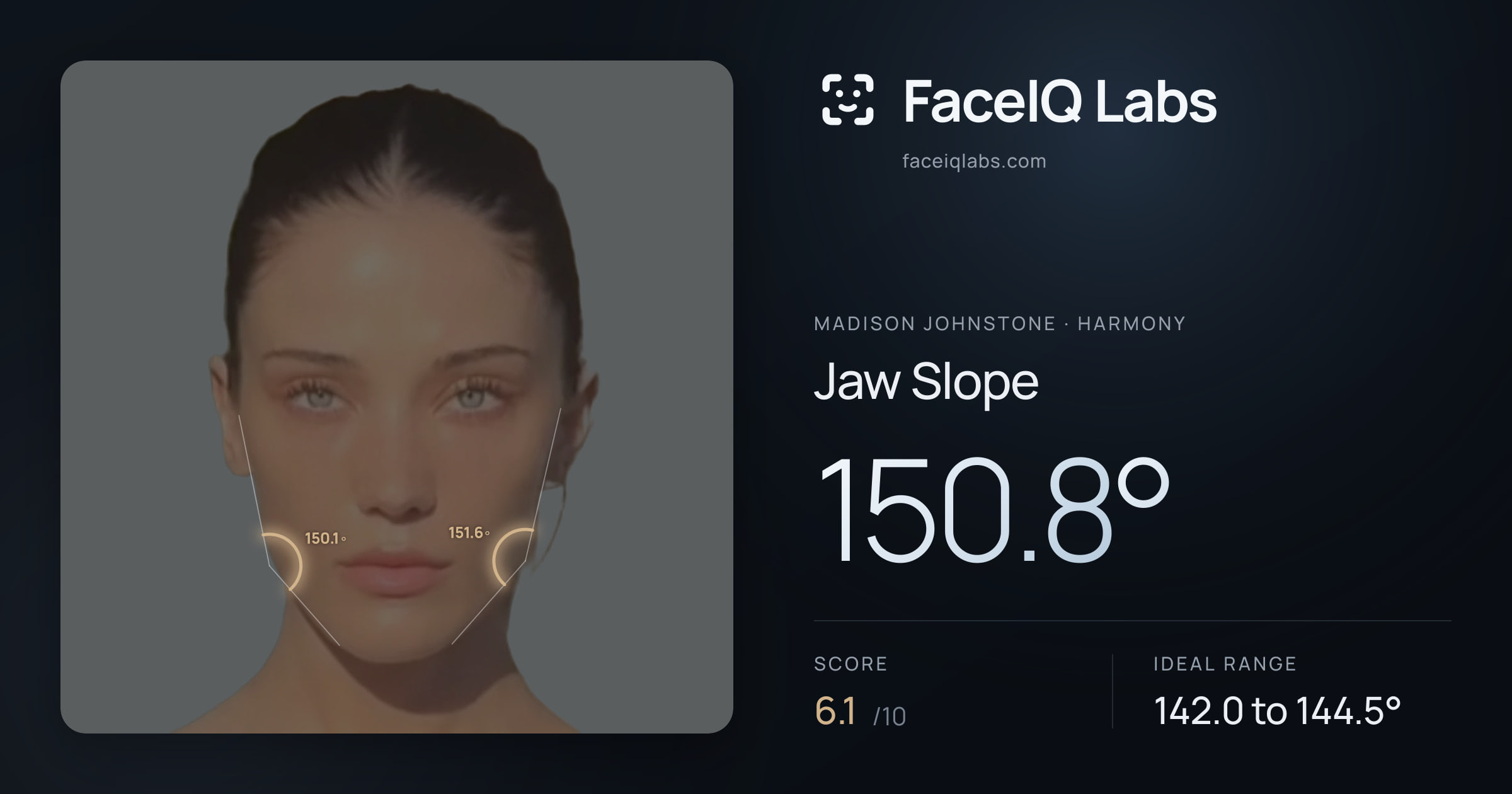 Madison Johnstone Jaw Slope: 150.8°, drawn on the photo