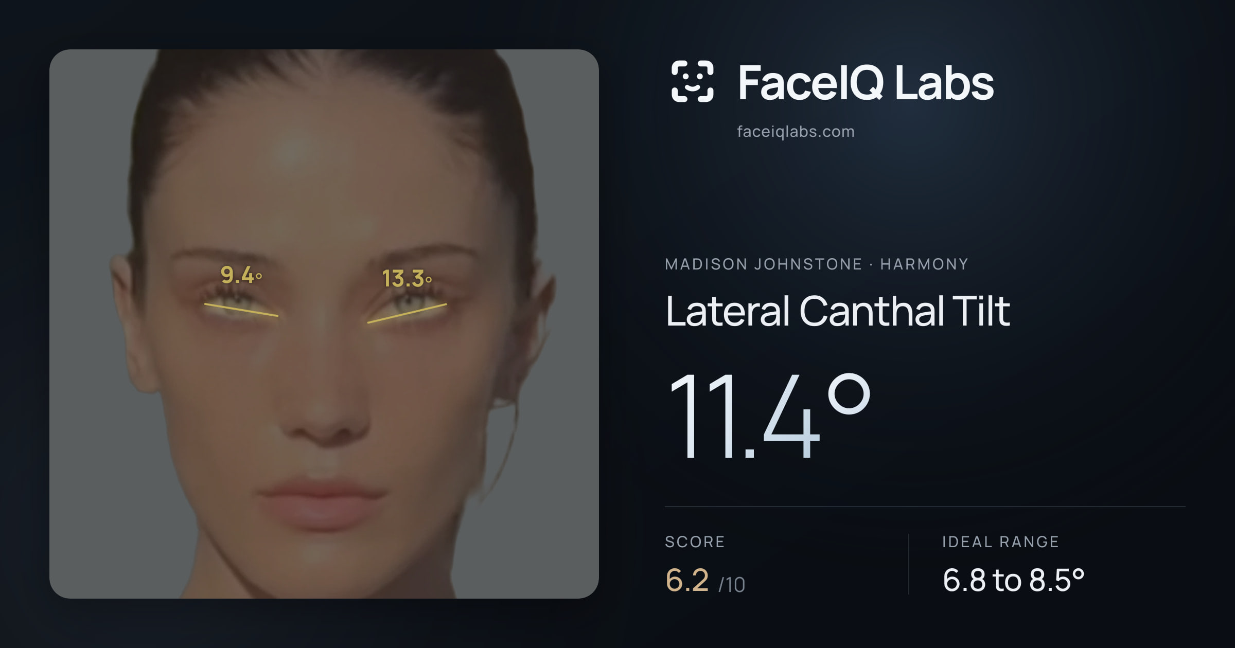 Madison Johnstone Lateral Canthal Tilt: 11.4°, drawn on the photo
