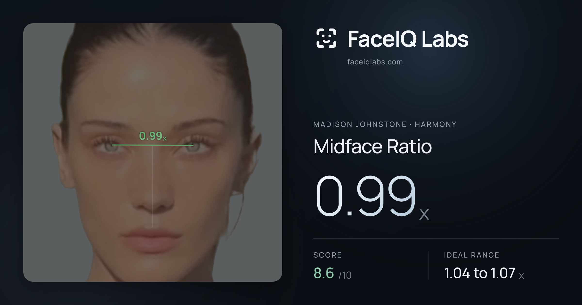 Madison Johnstone Midface Ratio: 0.99x, drawn on the photo