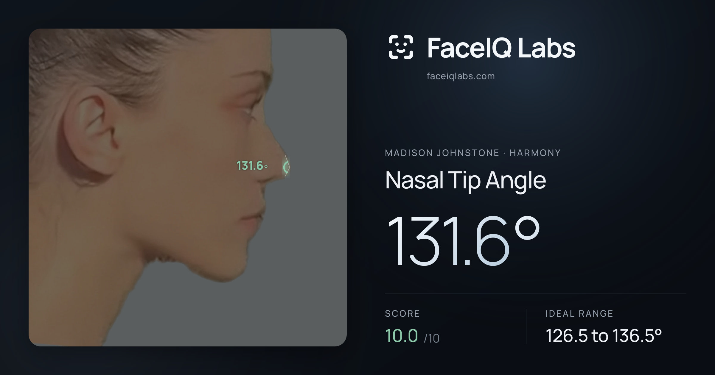Madison Johnstone Nasal Tip Angle: 131.6°, drawn on the photo